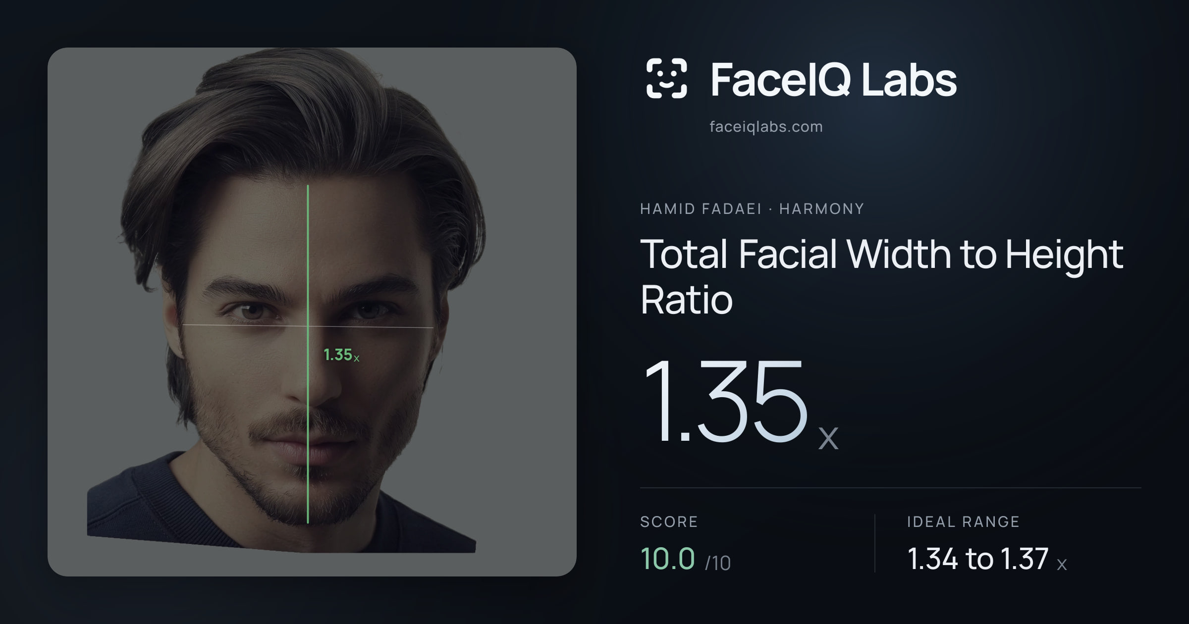 Hamid Fadaei Total Facial Width to Height Ratio: 1.35x, drawn on the photo