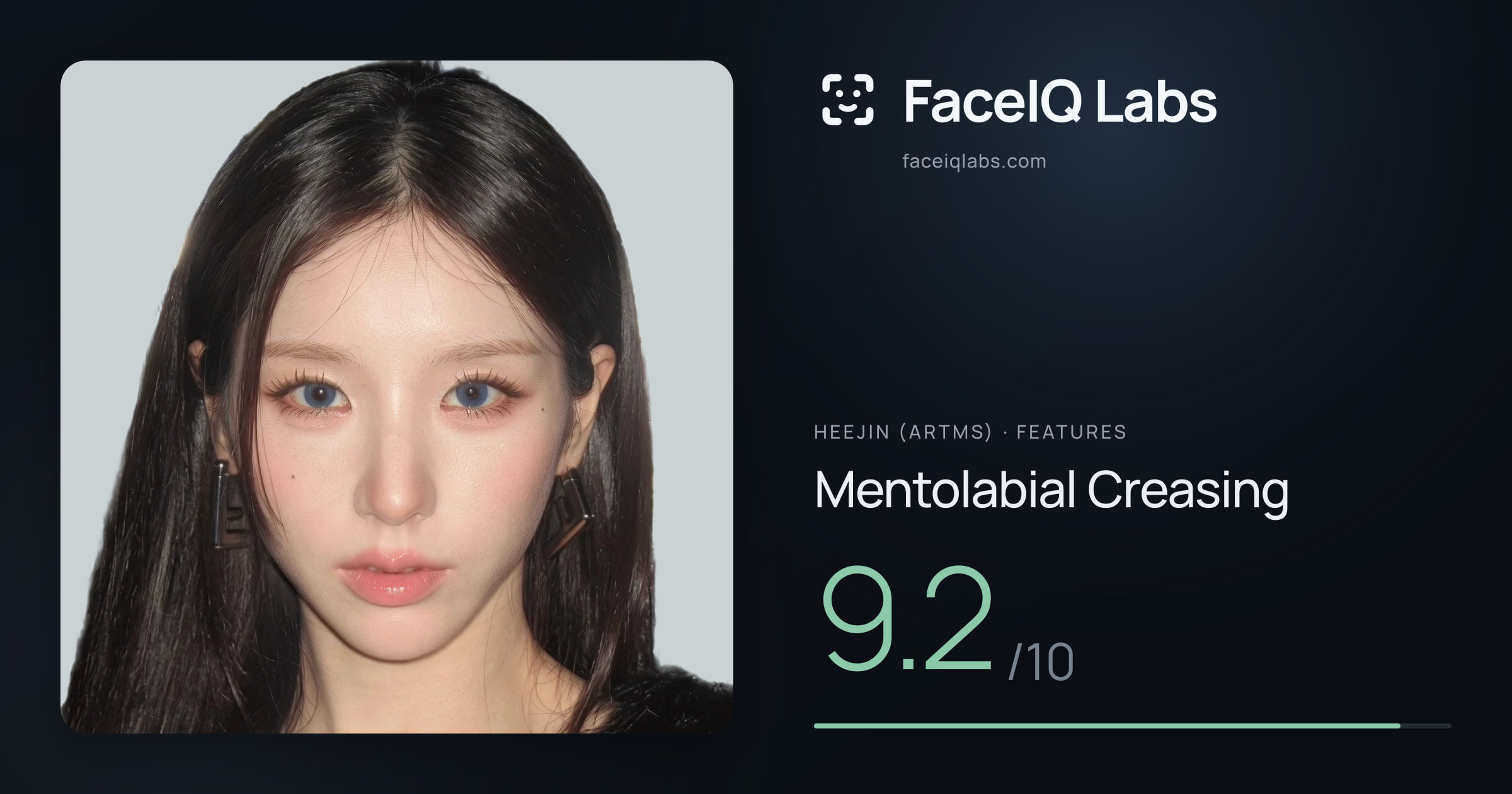 Heejin (ARTMS) Mentolabial Creasing: 9.2/10, drawn on the photo