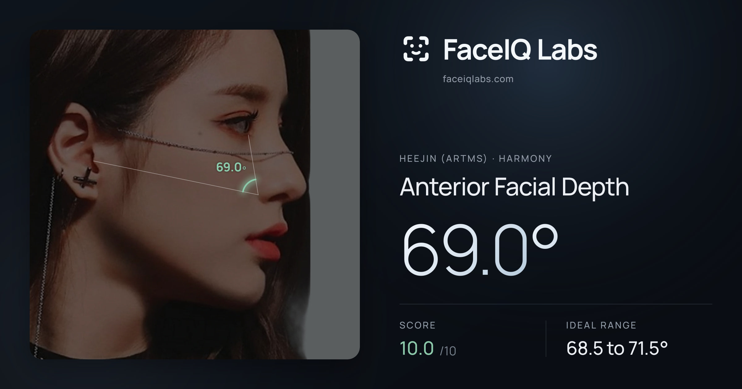 Heejin (ARTMS) Anterior Facial Depth: 69.0°, drawn on the photo