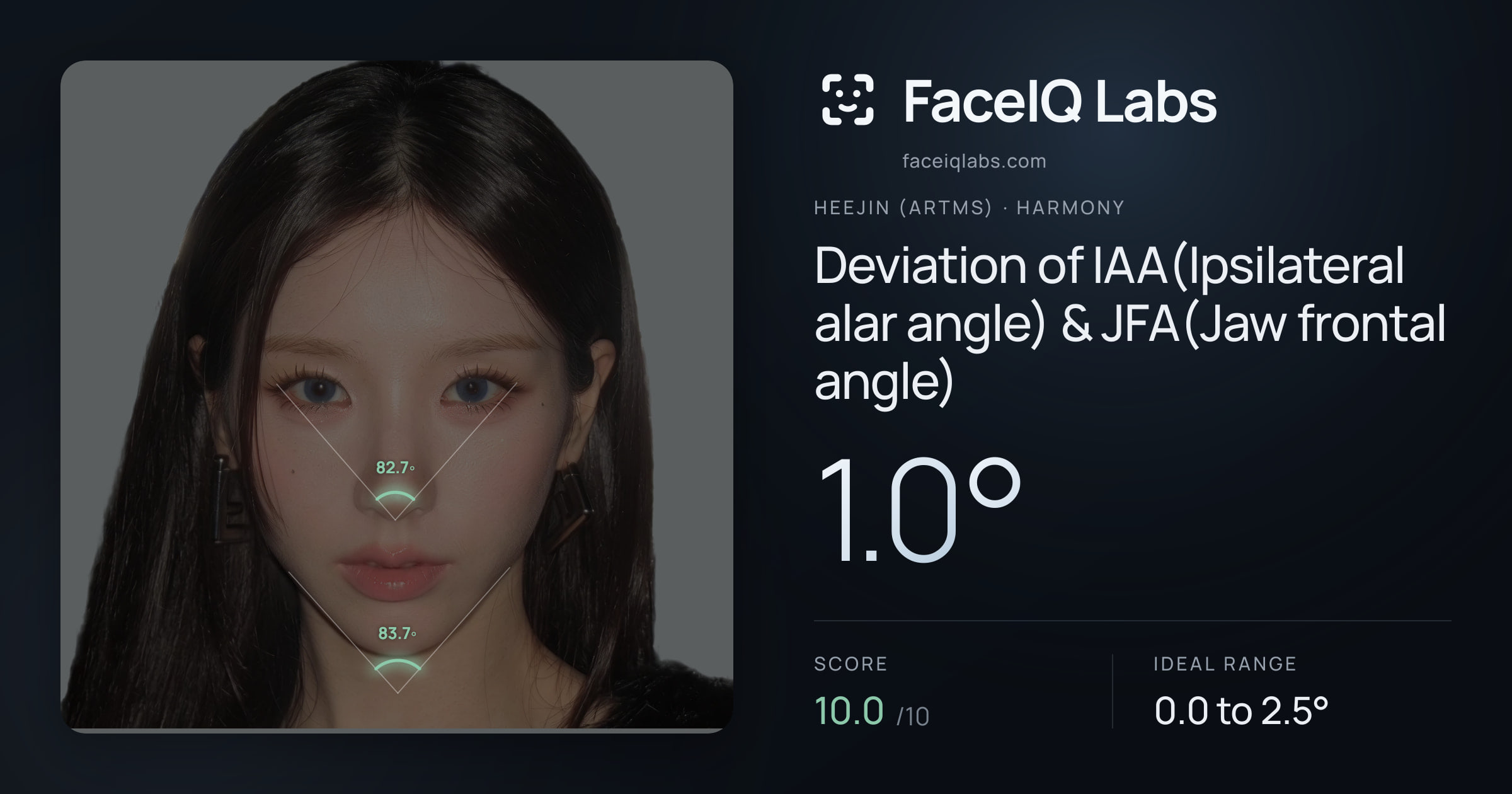 Heejin (ARTMS) Deviation of IAA(Ipsilateral alar angle) & JFA(Jaw frontal angle): 1.0°, drawn on the photo