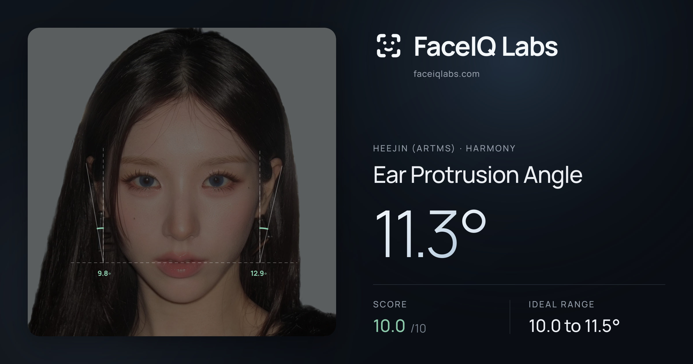 Heejin (ARTMS) Ear Protrusion Angle: 11.3°, drawn on the photo