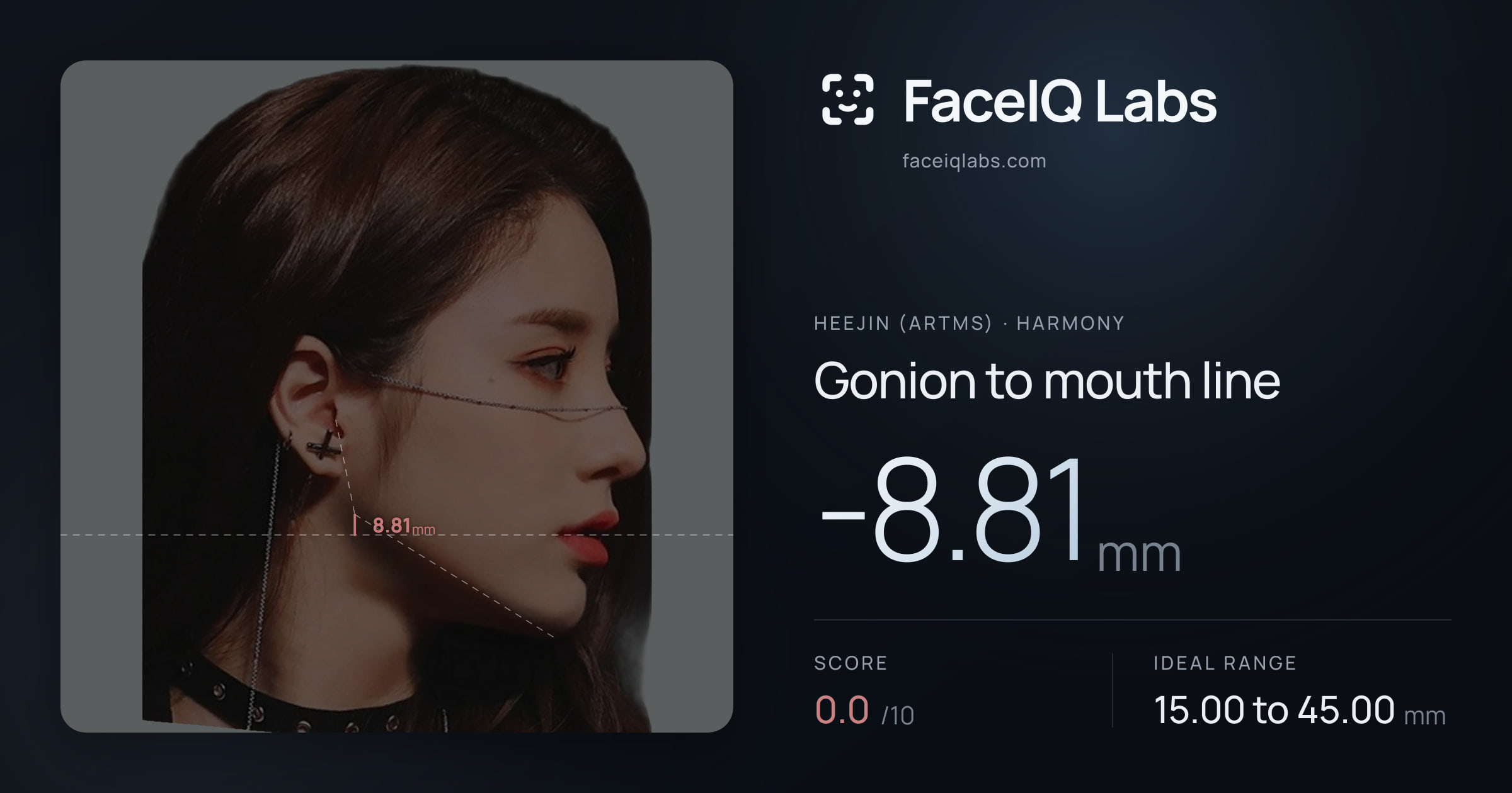 Heejin (ARTMS) Gonion to mouth line: -8.81mm, drawn on the photo