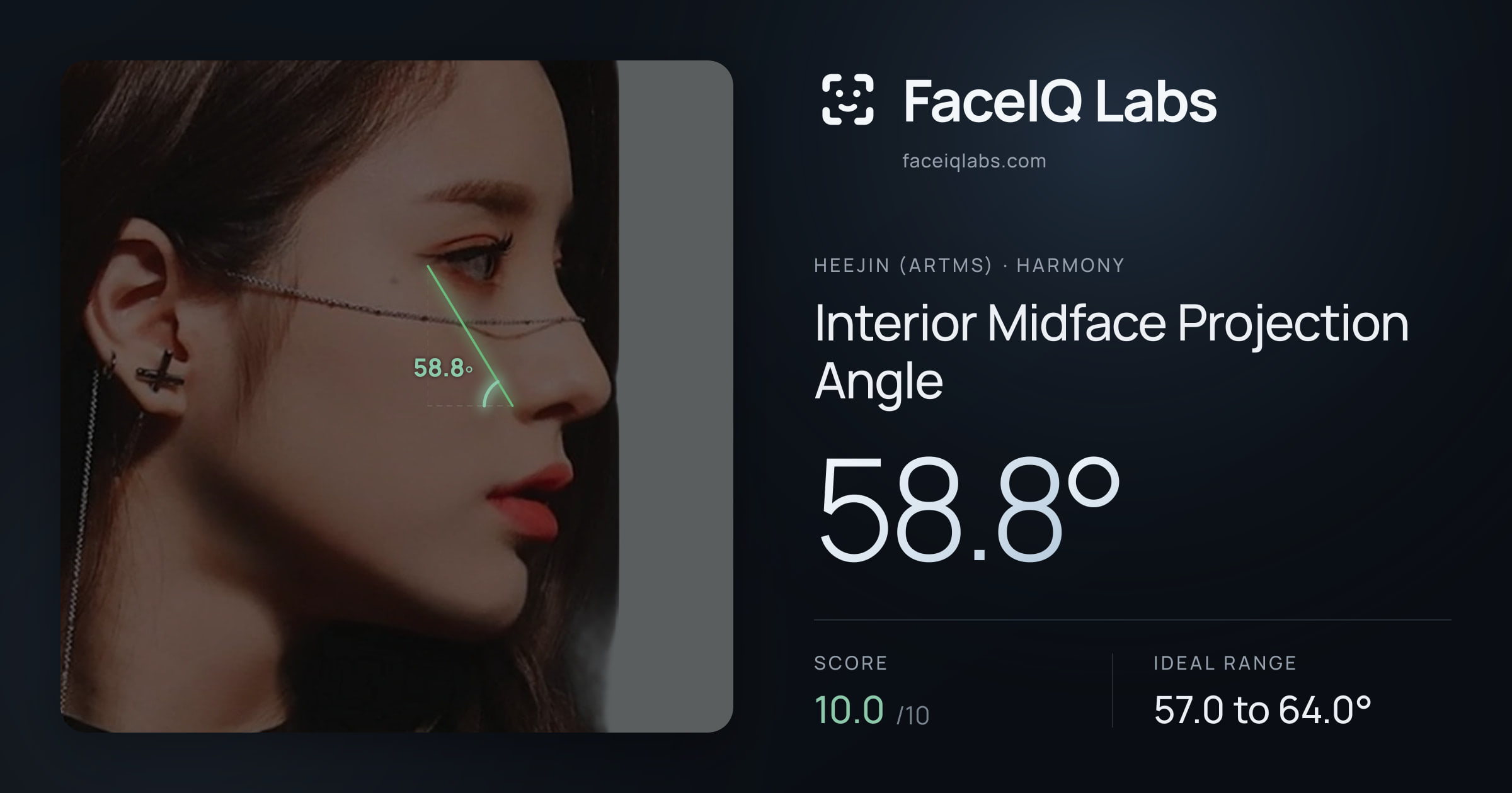 Heejin (ARTMS) Interior Midface Projection Angle: 58.8°, drawn on the photo