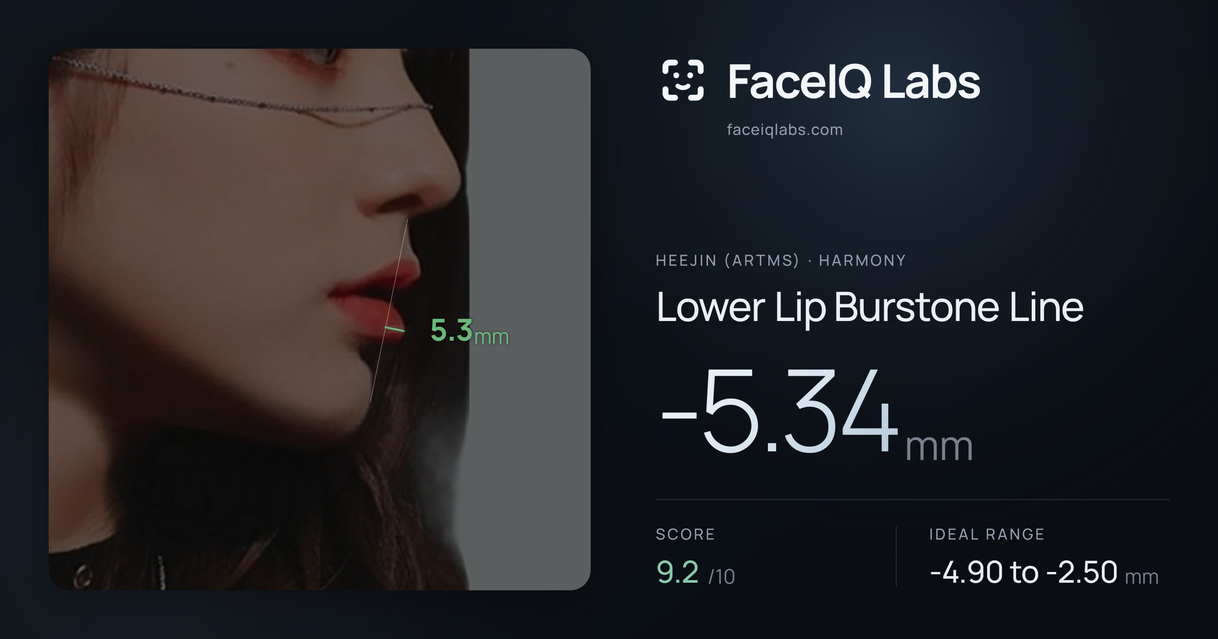 Heejin (ARTMS) Lower Lip Burstone Line: -5.34mm, drawn on the photo