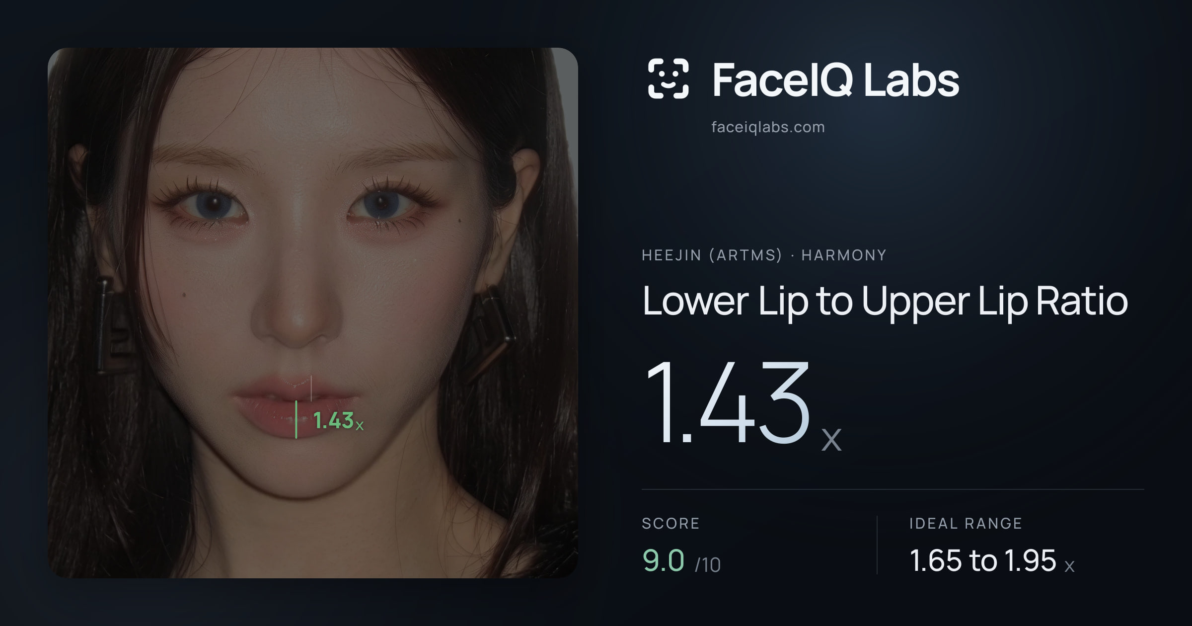 Heejin (ARTMS) Lower Lip to Upper Lip Ratio: 1.43x, drawn on the photo
