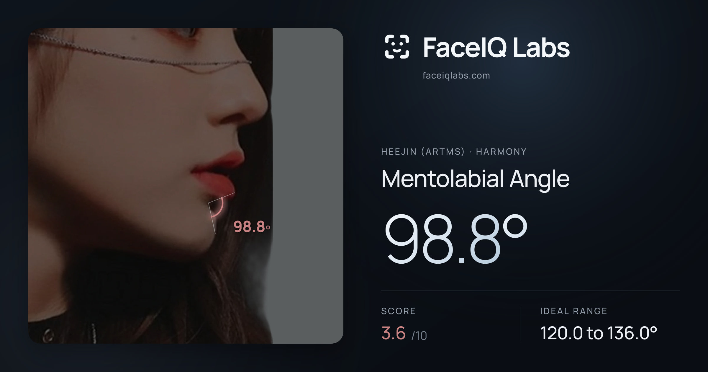 Heejin (ARTMS) Mentolabial Angle: 98.8°, drawn on the photo