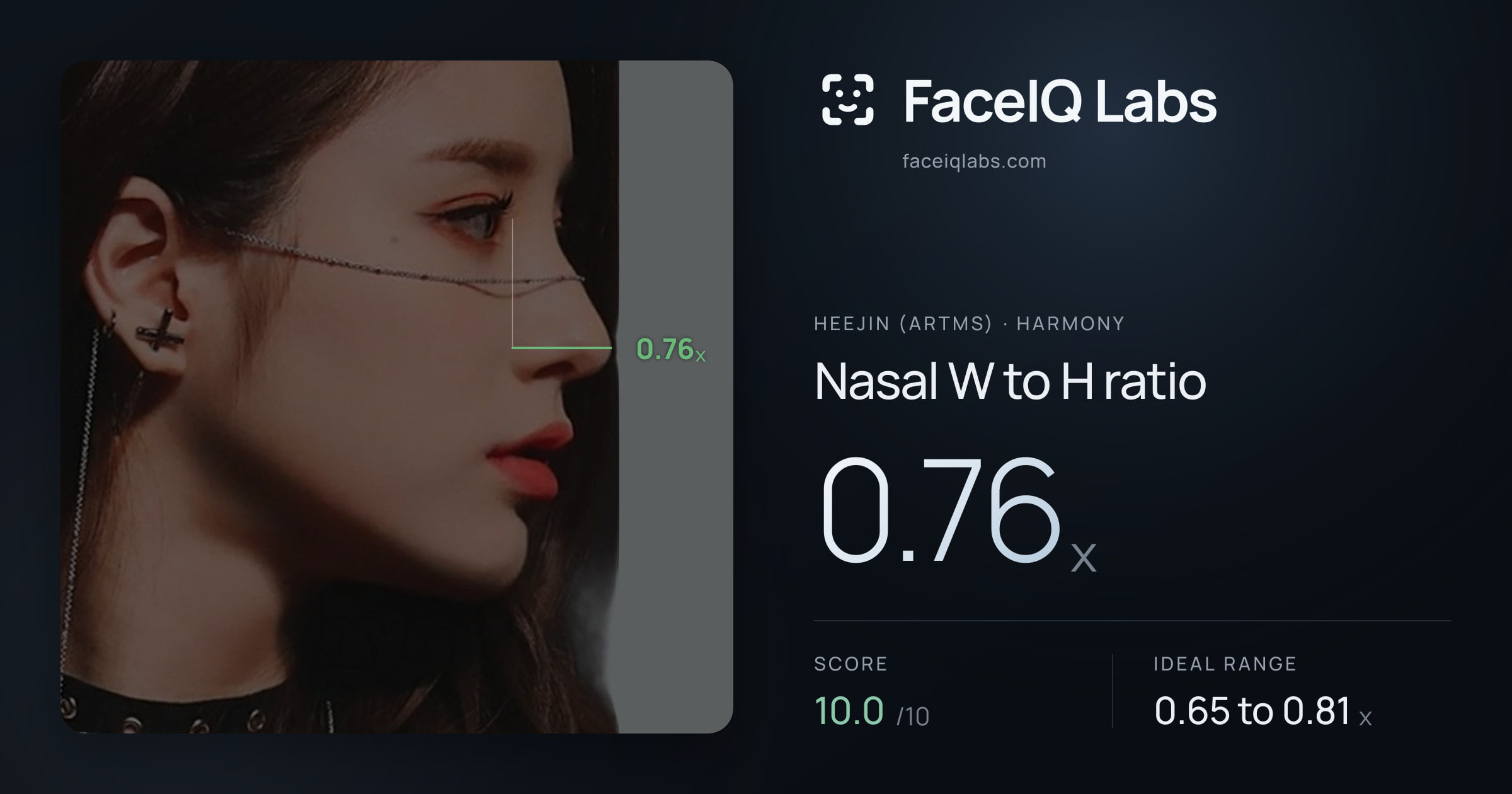 Heejin (ARTMS) Nasal W to H ratio: 0.76x, drawn on the photo