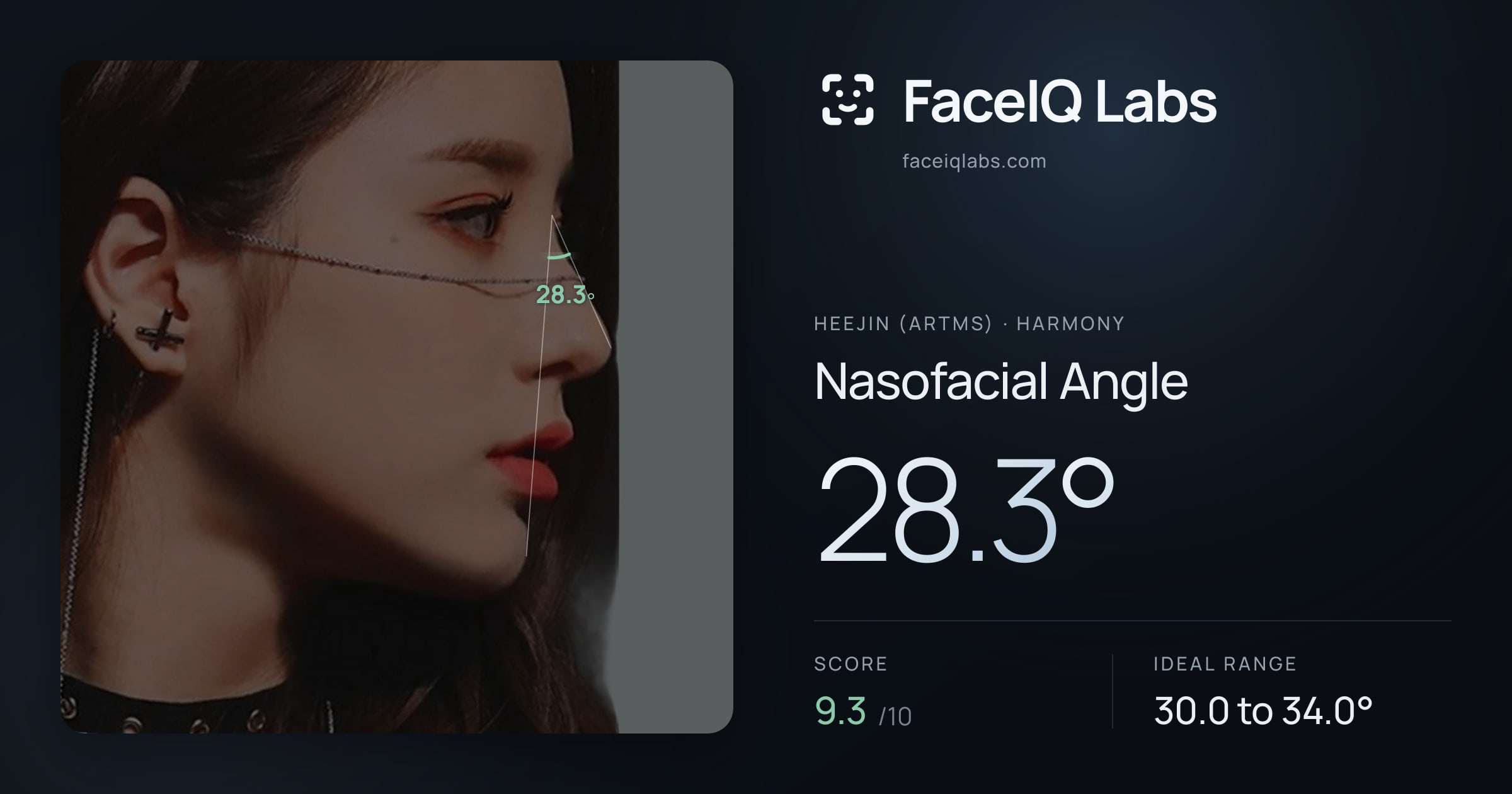 Heejin (ARTMS) Nasofacial Angle: 28.3°, drawn on the photo