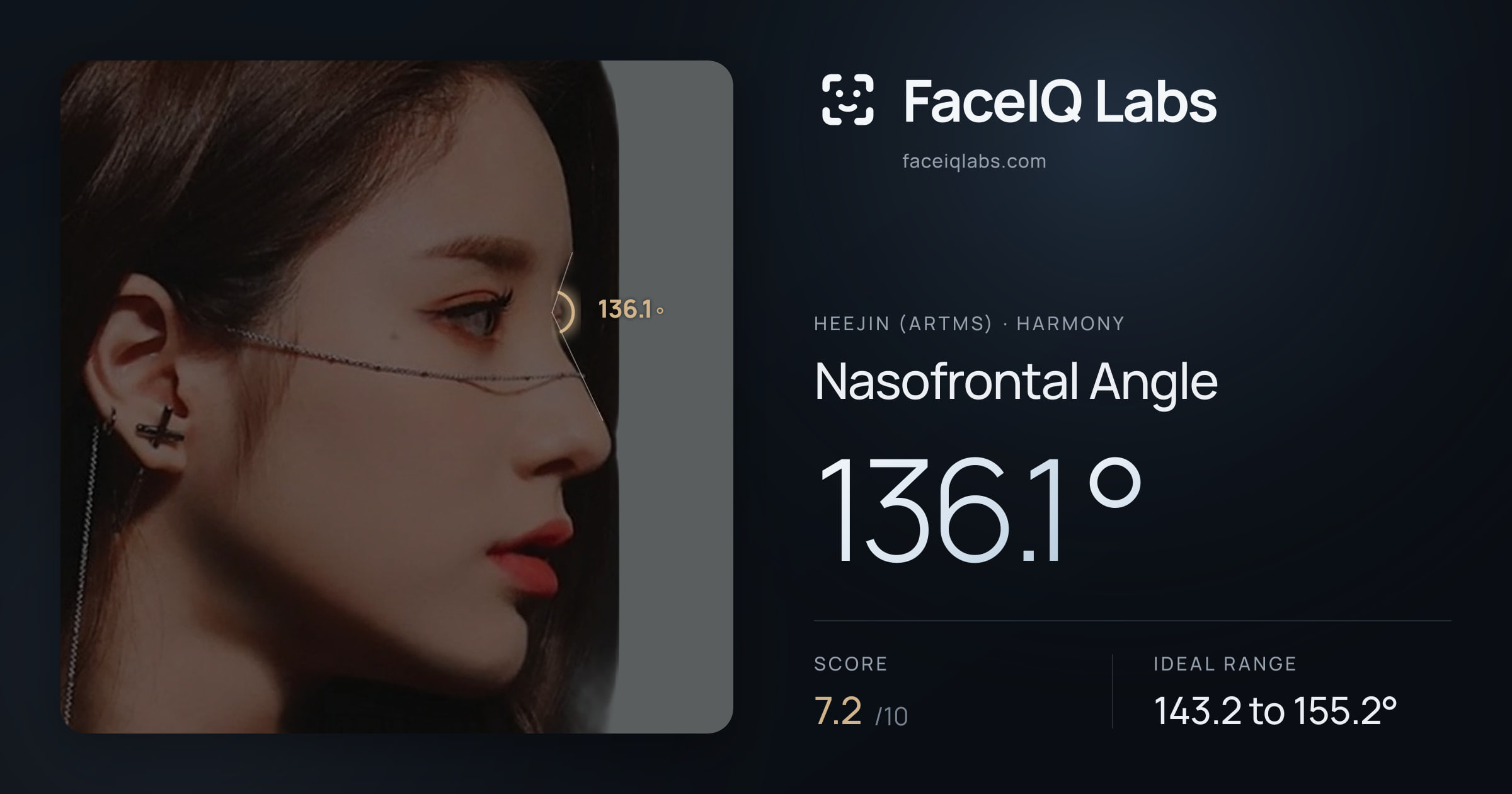 Heejin (ARTMS) Nasofrontal Angle: 136.1°, drawn on the photo