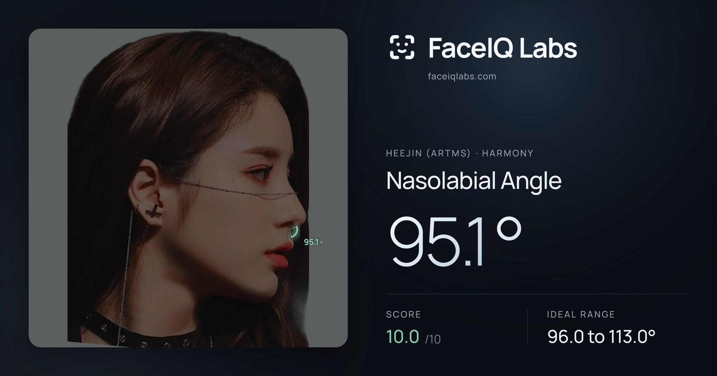 Heejin (ARTMS) Nasolabial Angle: 95.1°, drawn on the photo