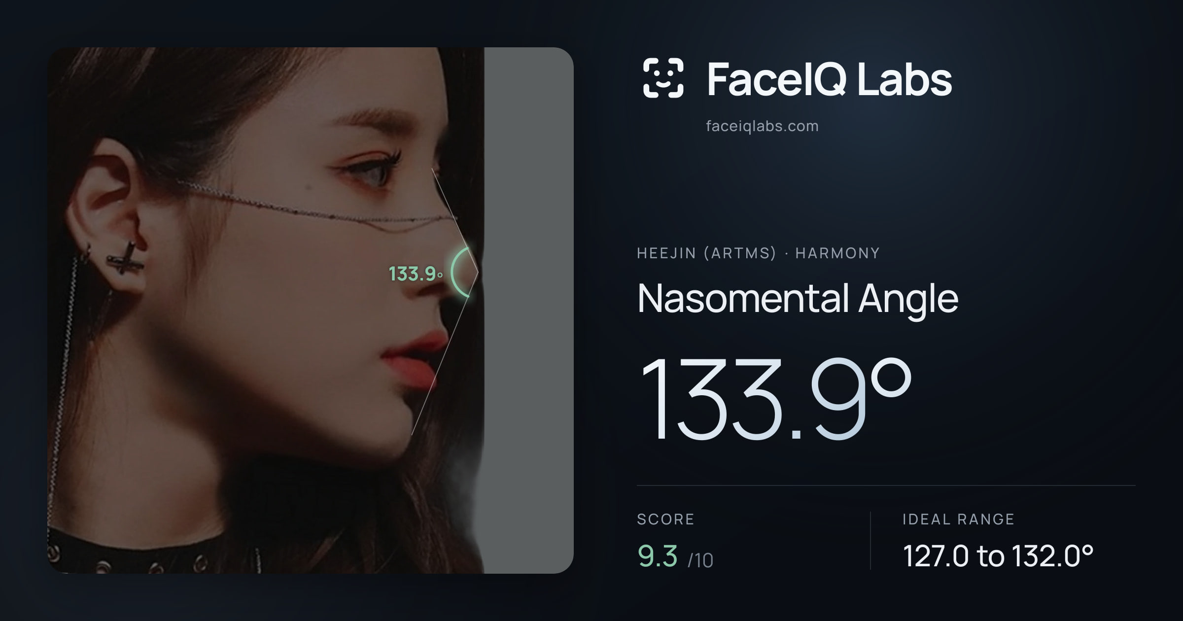 Heejin (ARTMS) Nasomental Angle: 133.9°, drawn on the photo