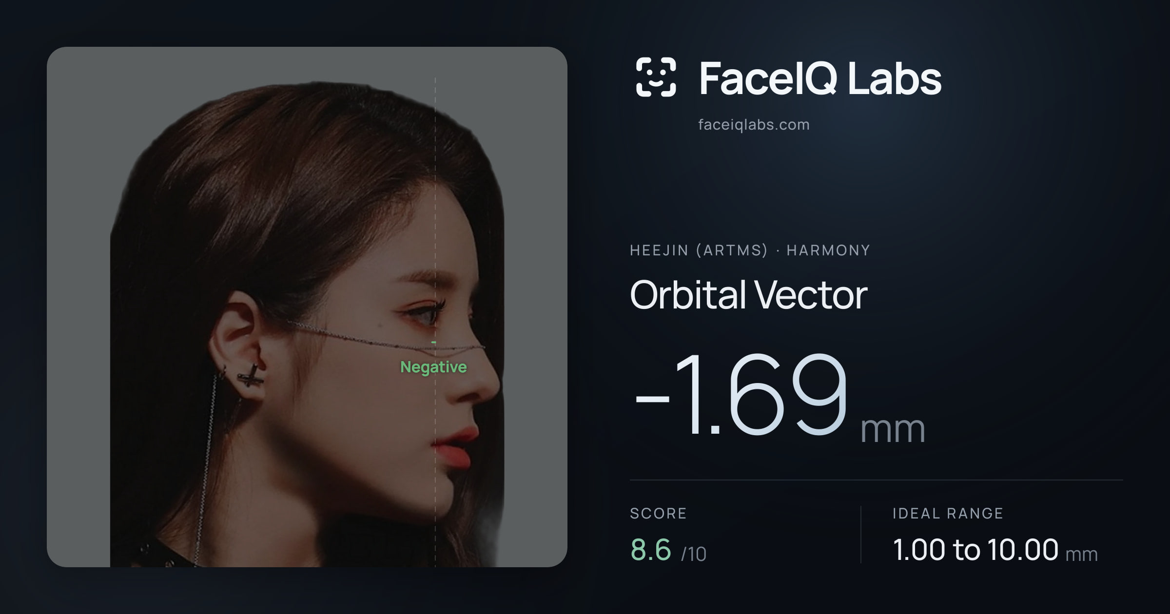Heejin (ARTMS) Orbital Vector: -1.69mm, drawn on the photo