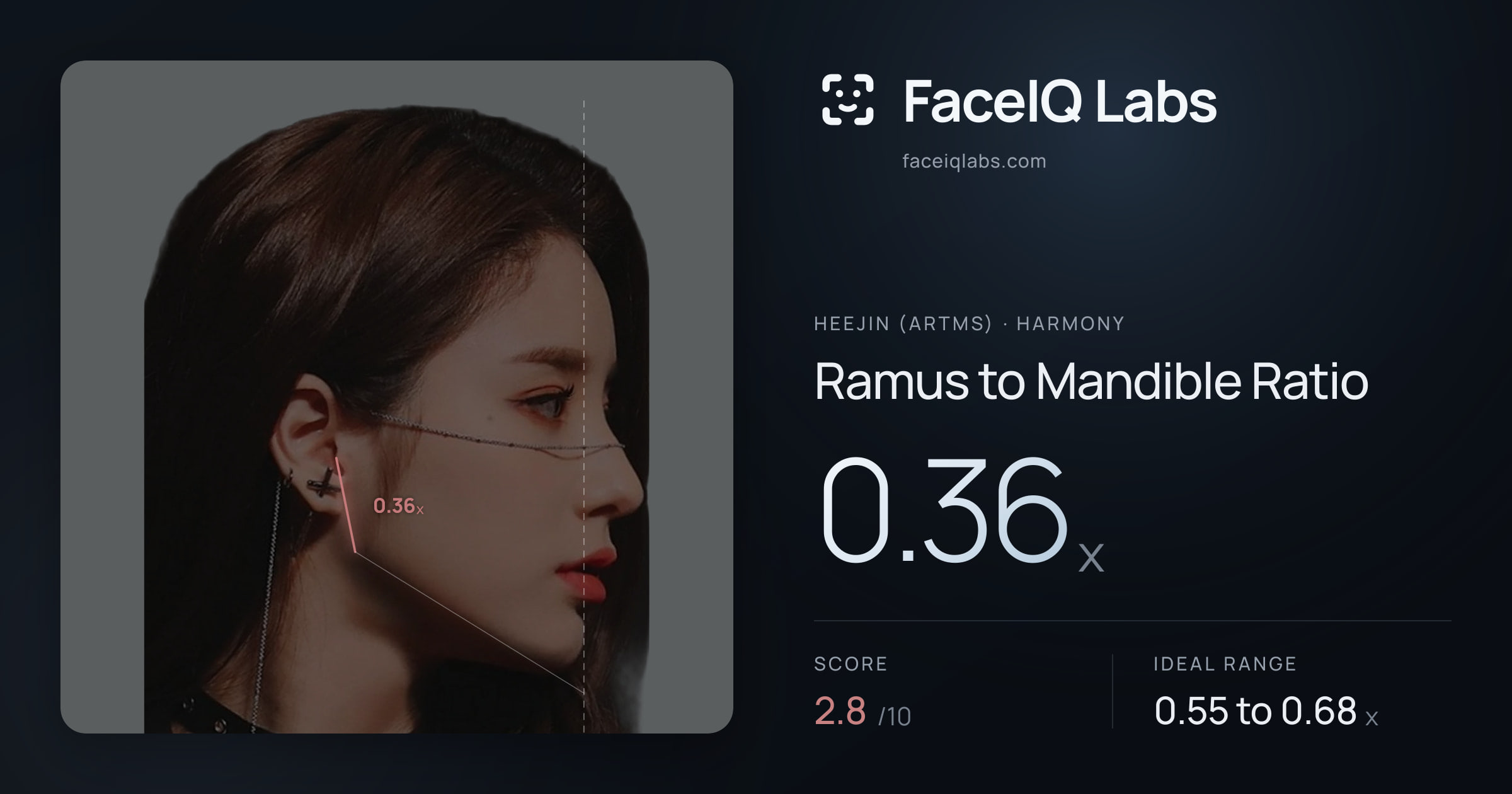 Heejin (ARTMS) Ramus to Mandible Ratio: 0.36x, drawn on the photo
