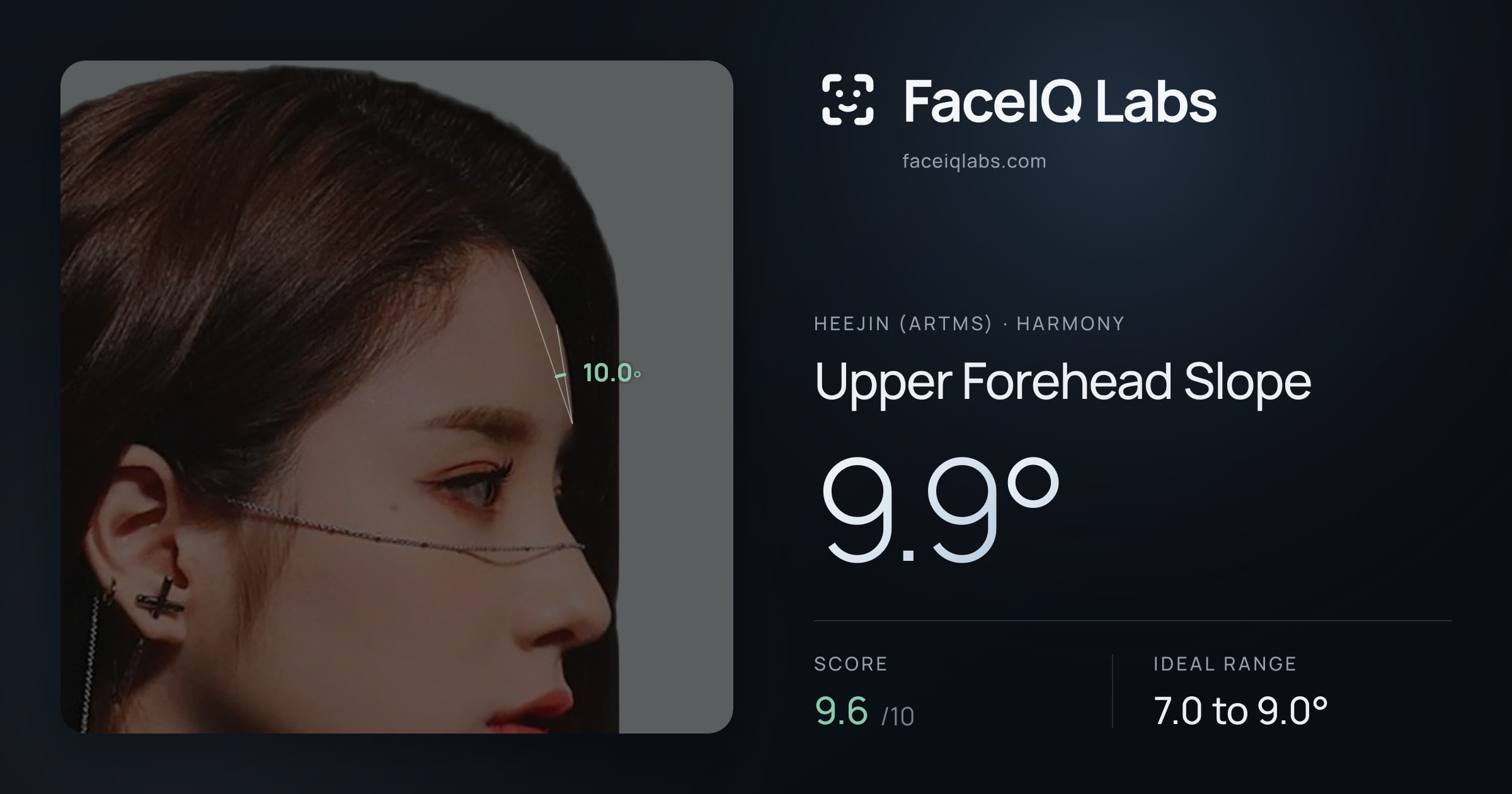 Heejin (ARTMS) Upper Forehead Slope: 9.9°, drawn on the photo