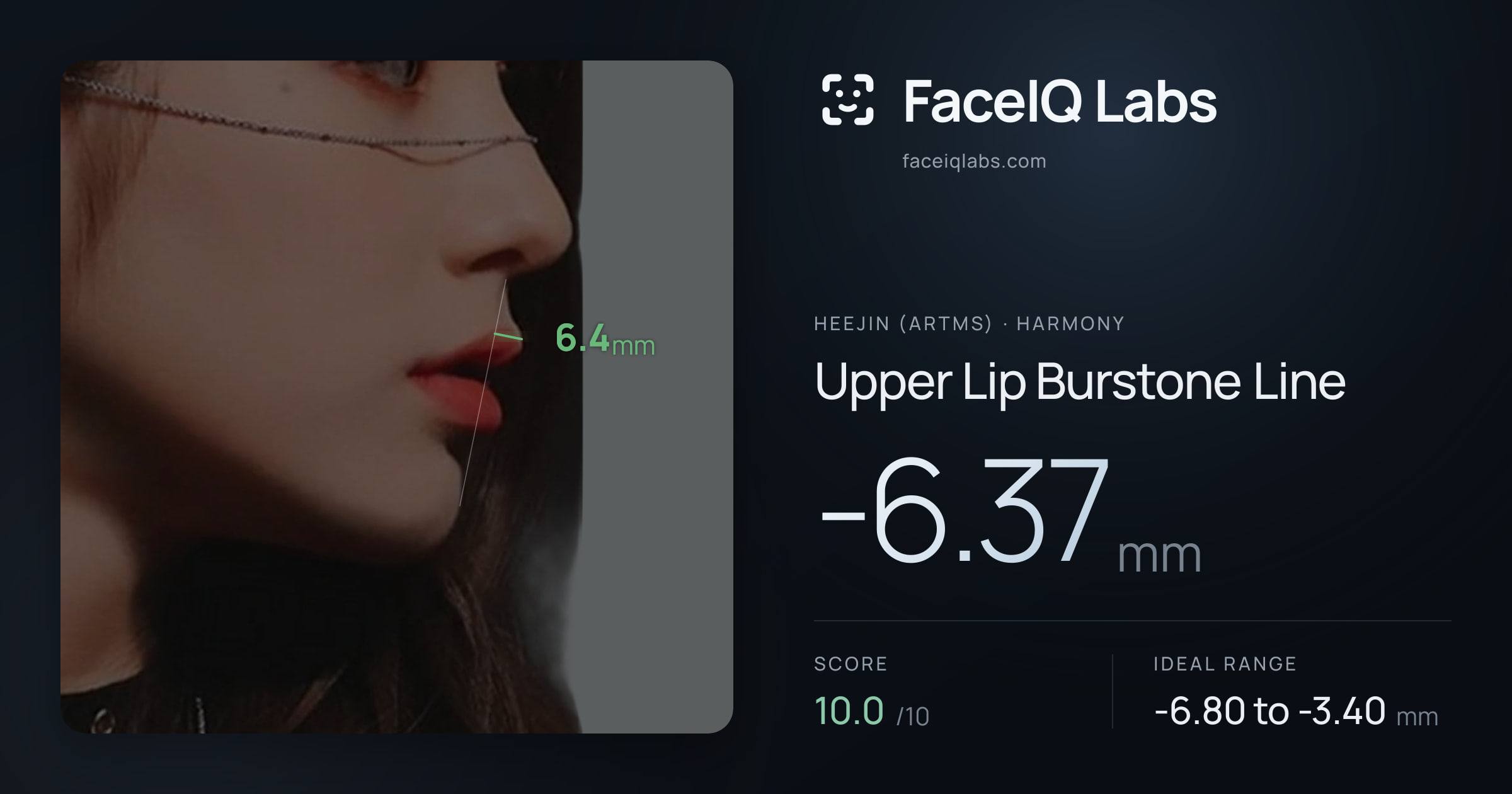 Heejin (ARTMS) Upper Lip Burstone Line: -6.37mm, drawn on the photo