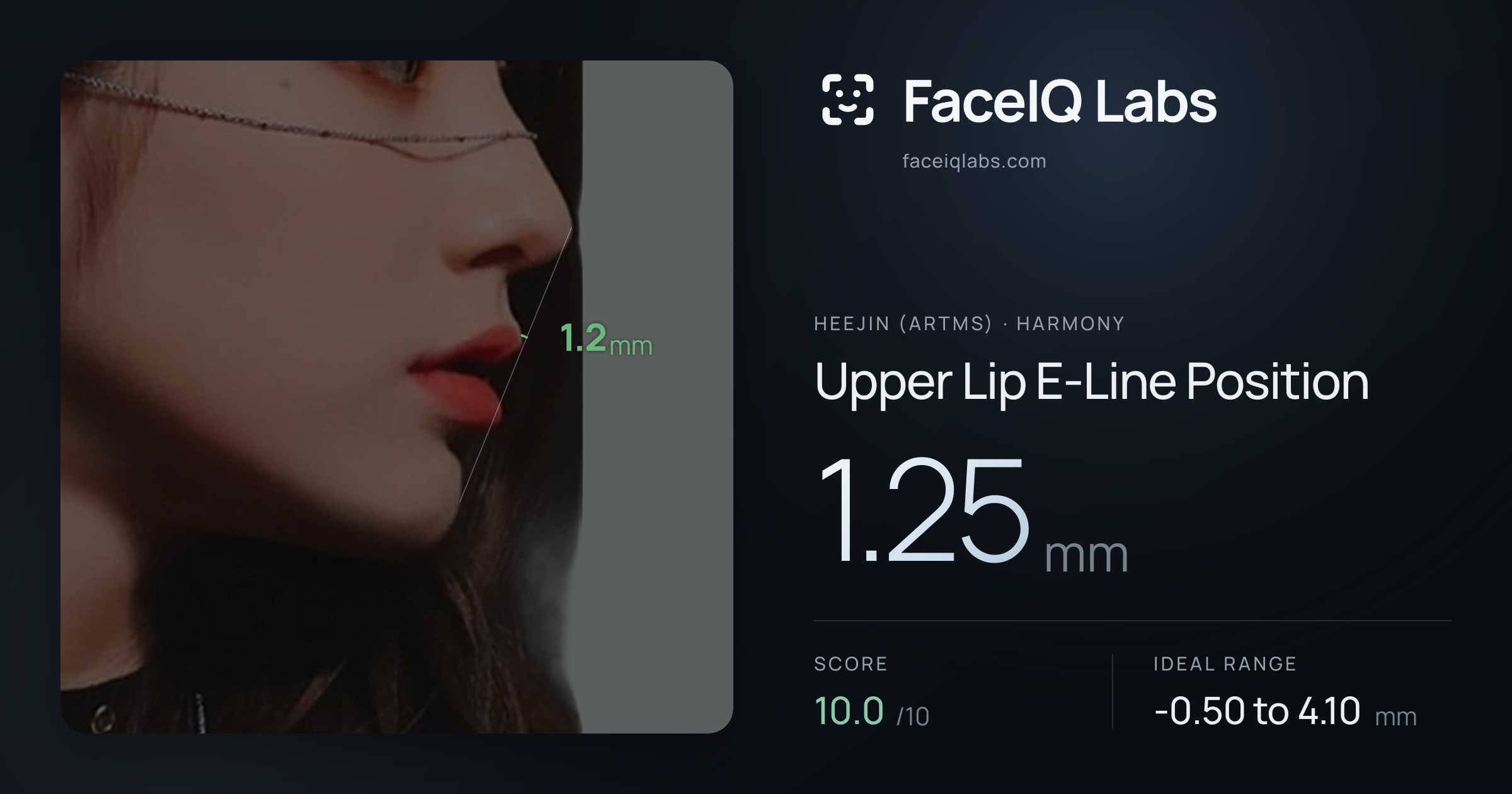 Heejin (ARTMS) Upper Lip E-Line Position: 1.25mm, drawn on the photo