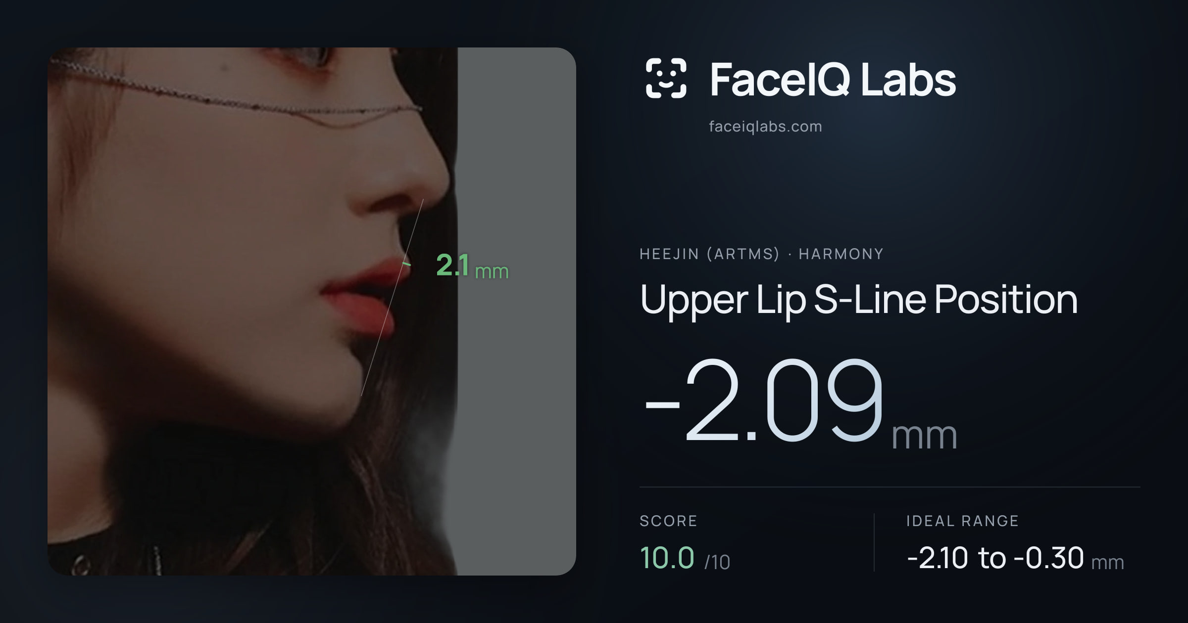 Heejin (ARTMS) Upper Lip S-Line Position: -2.09mm, drawn on the photo