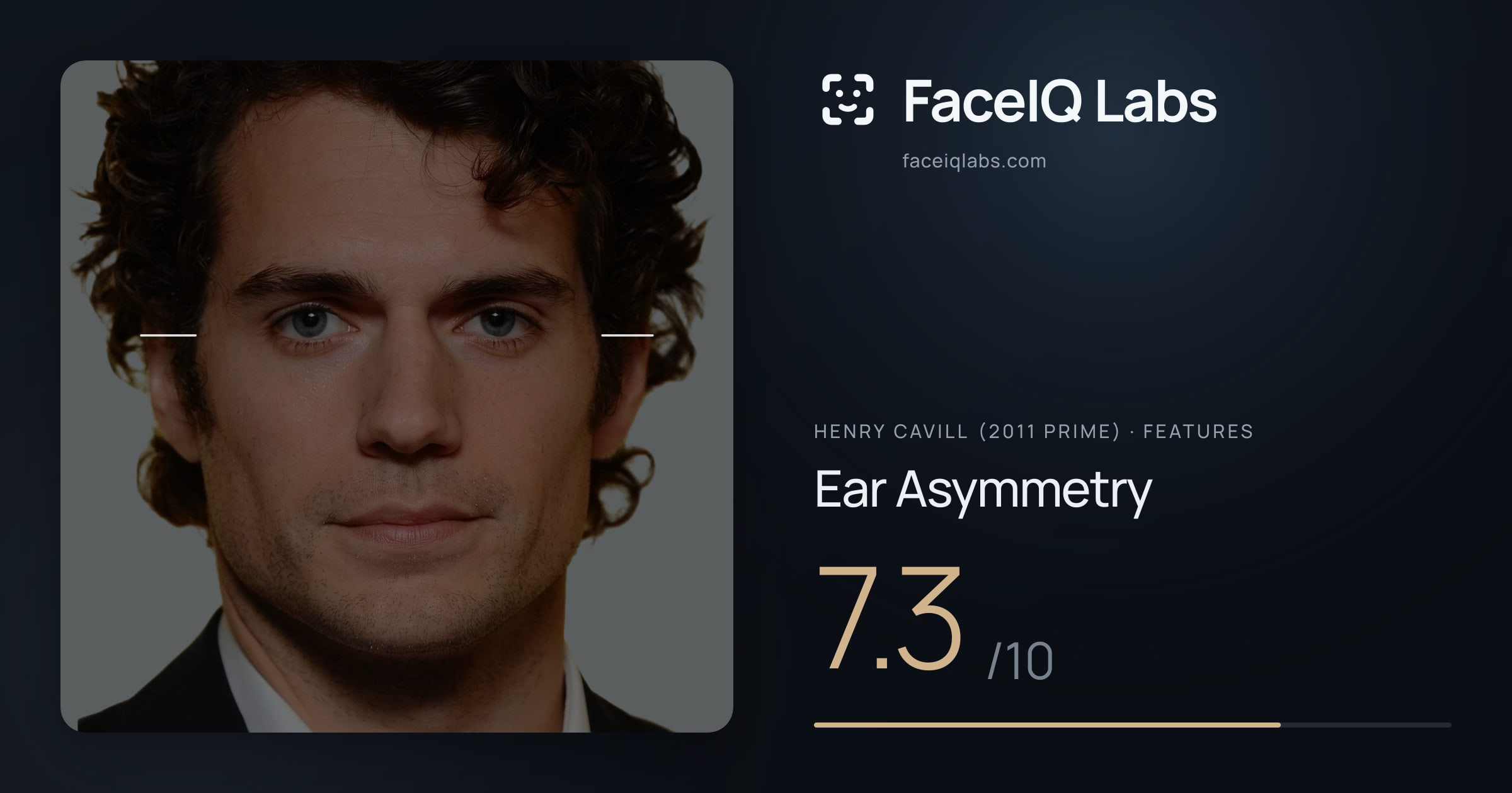 Henry Cavill (2011 Prime) Ear Asymmetry: 7.3/10, drawn on the photo