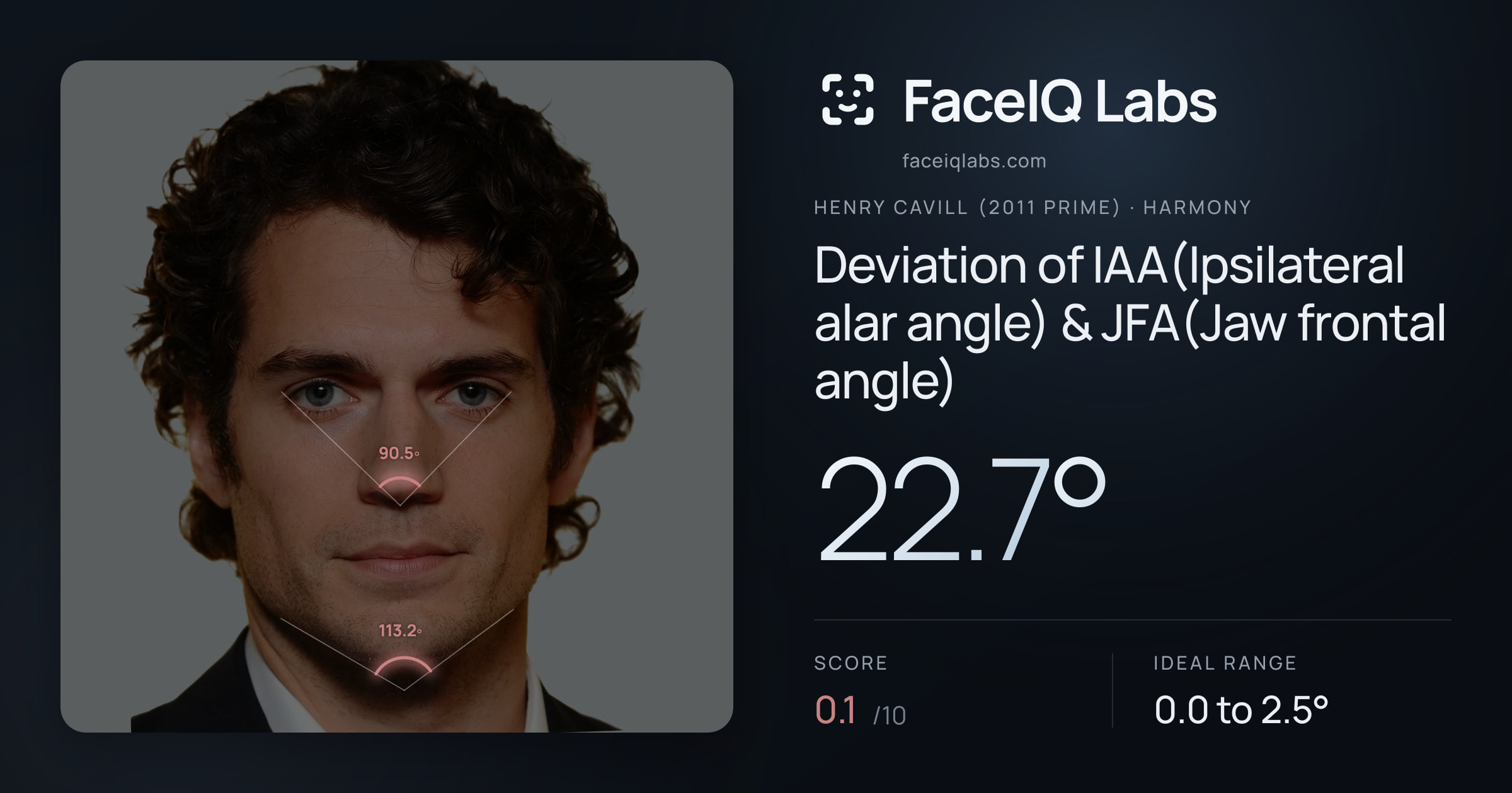 Henry Cavill (2011 Prime) Deviation of IAA(Ipsilateral alar angle) & JFA(Jaw frontal angle): 22.7°, drawn on the photo