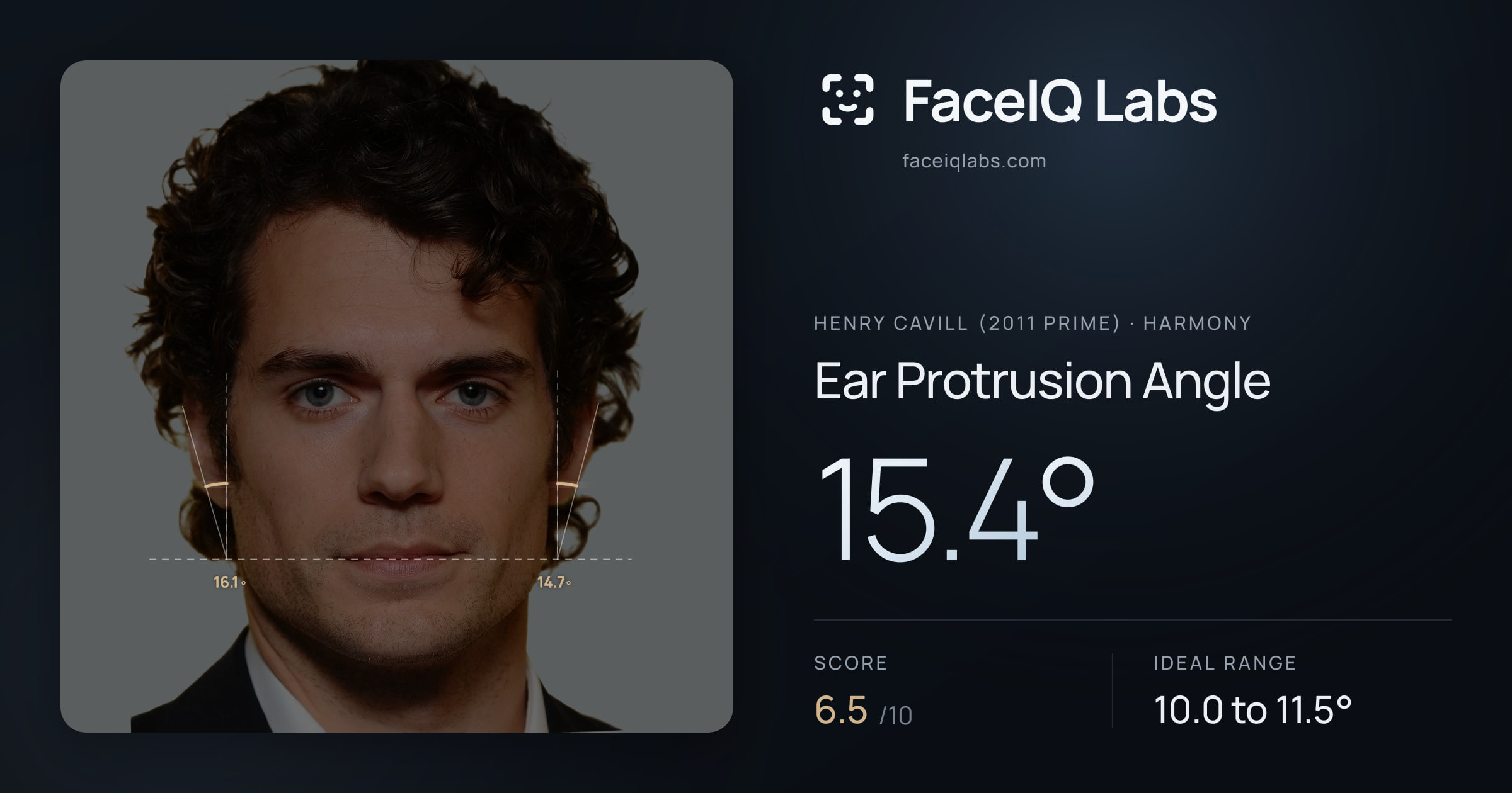 Henry Cavill (2011 Prime) Ear Protrusion Angle: 15.4°, drawn on the photo