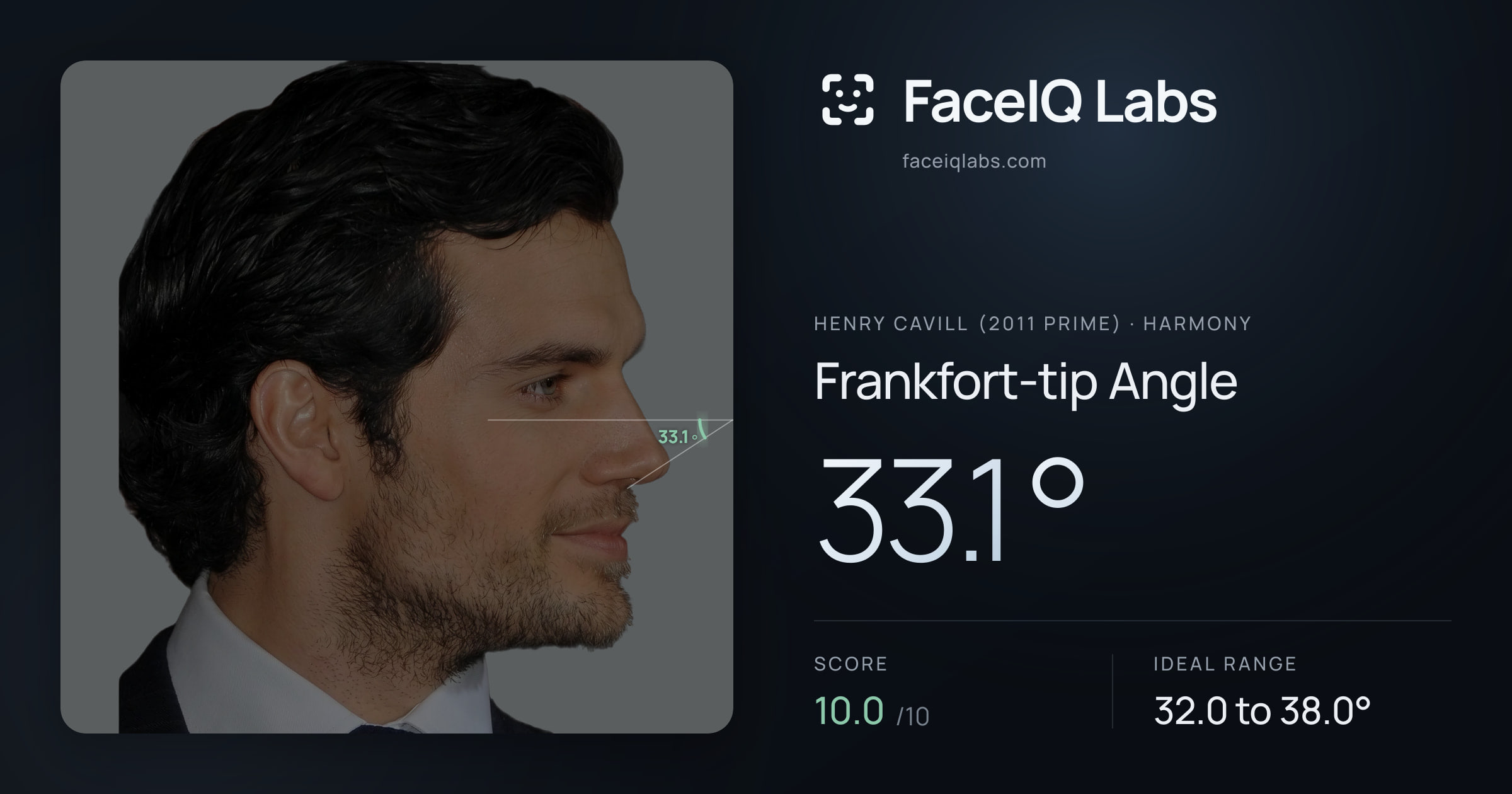 Henry Cavill (2011 Prime) Frankfort-tip Angle: 33.1°, drawn on the photo