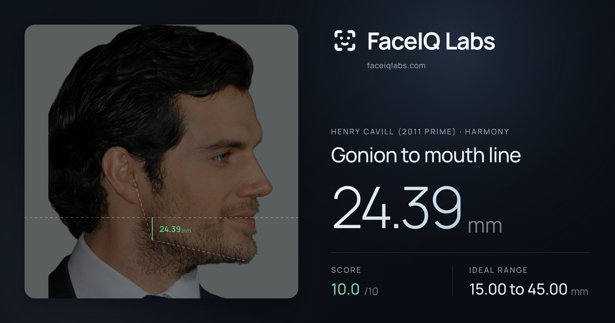 Henry Cavill (2011 Prime) Gonion to mouth line: 24.39mm, drawn on the photo