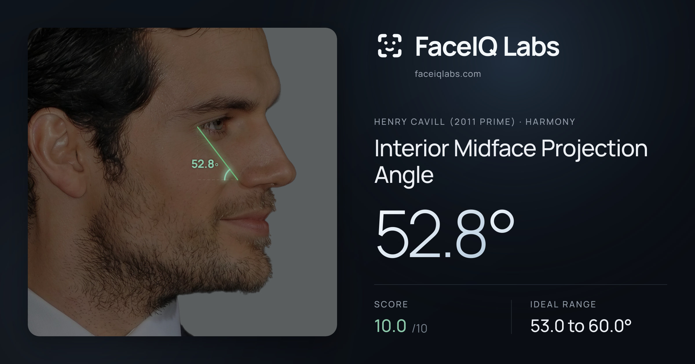 Henry Cavill (2011 Prime) Interior Midface Projection Angle: 52.8°, drawn on the photo