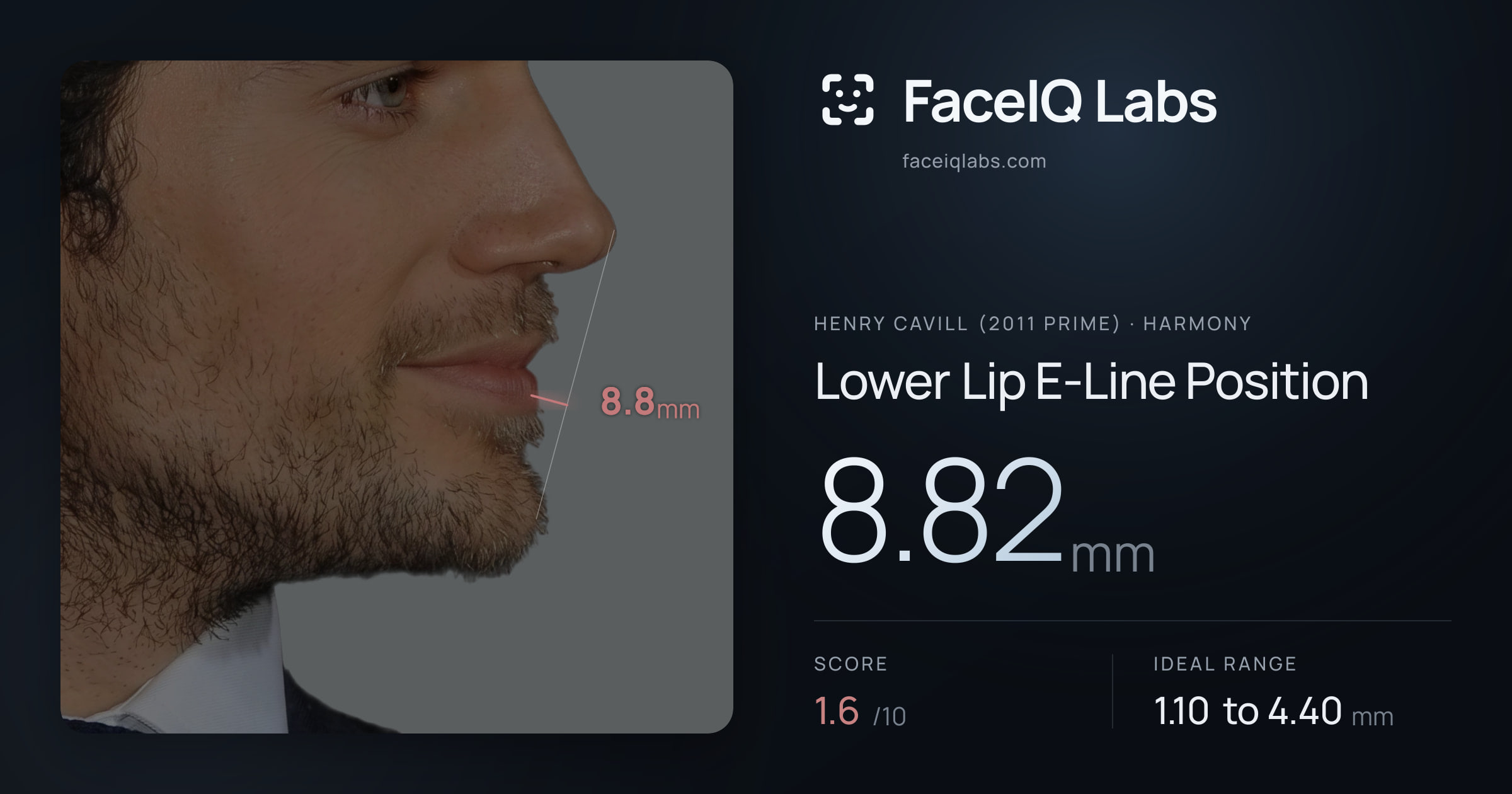 Henry Cavill (2011 Prime) Lower Lip E-Line Position: 8.82mm, drawn on the photo