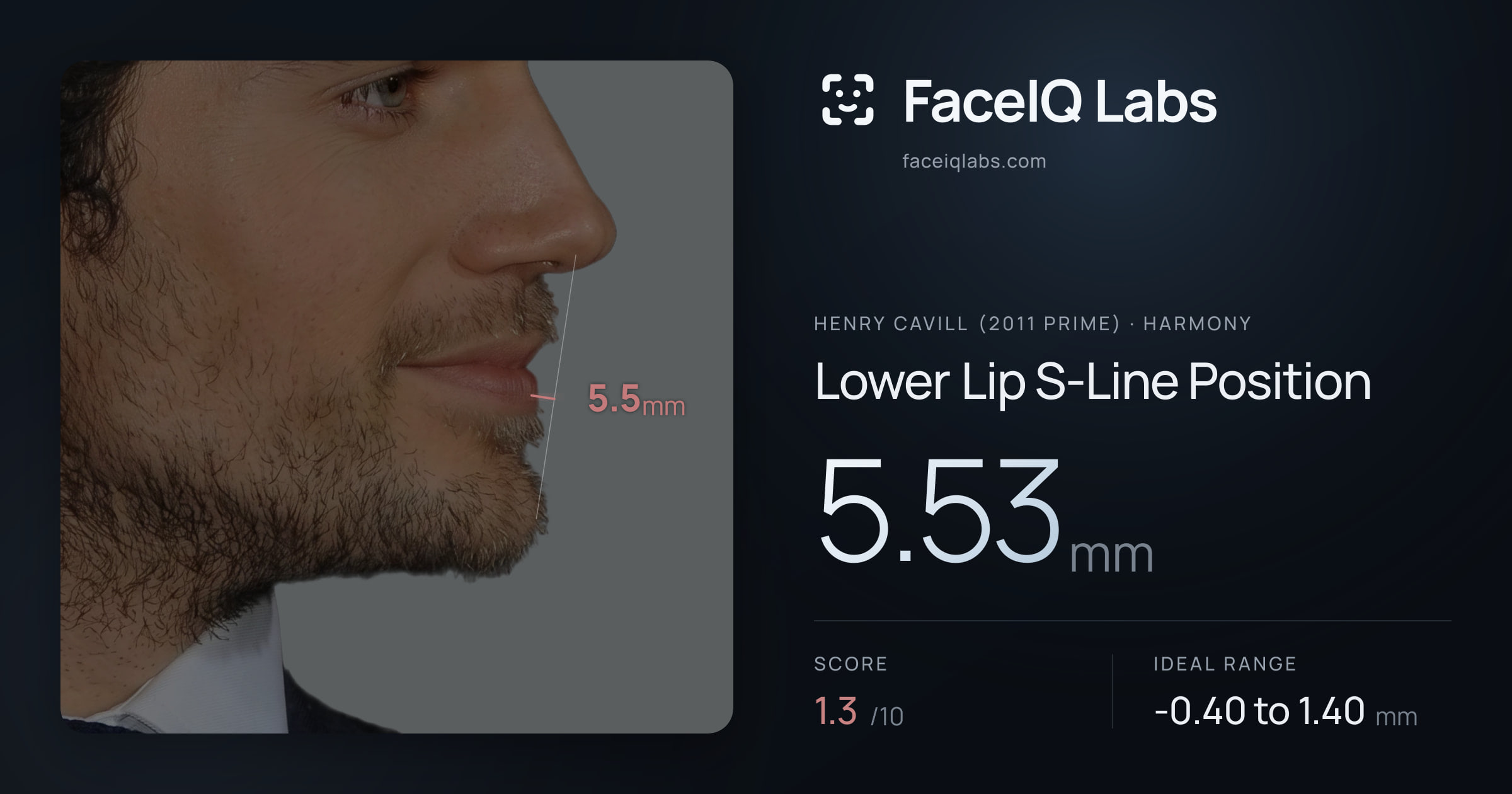 Henry Cavill (2011 Prime) Lower Lip S-Line Position: 5.53mm, drawn on the photo