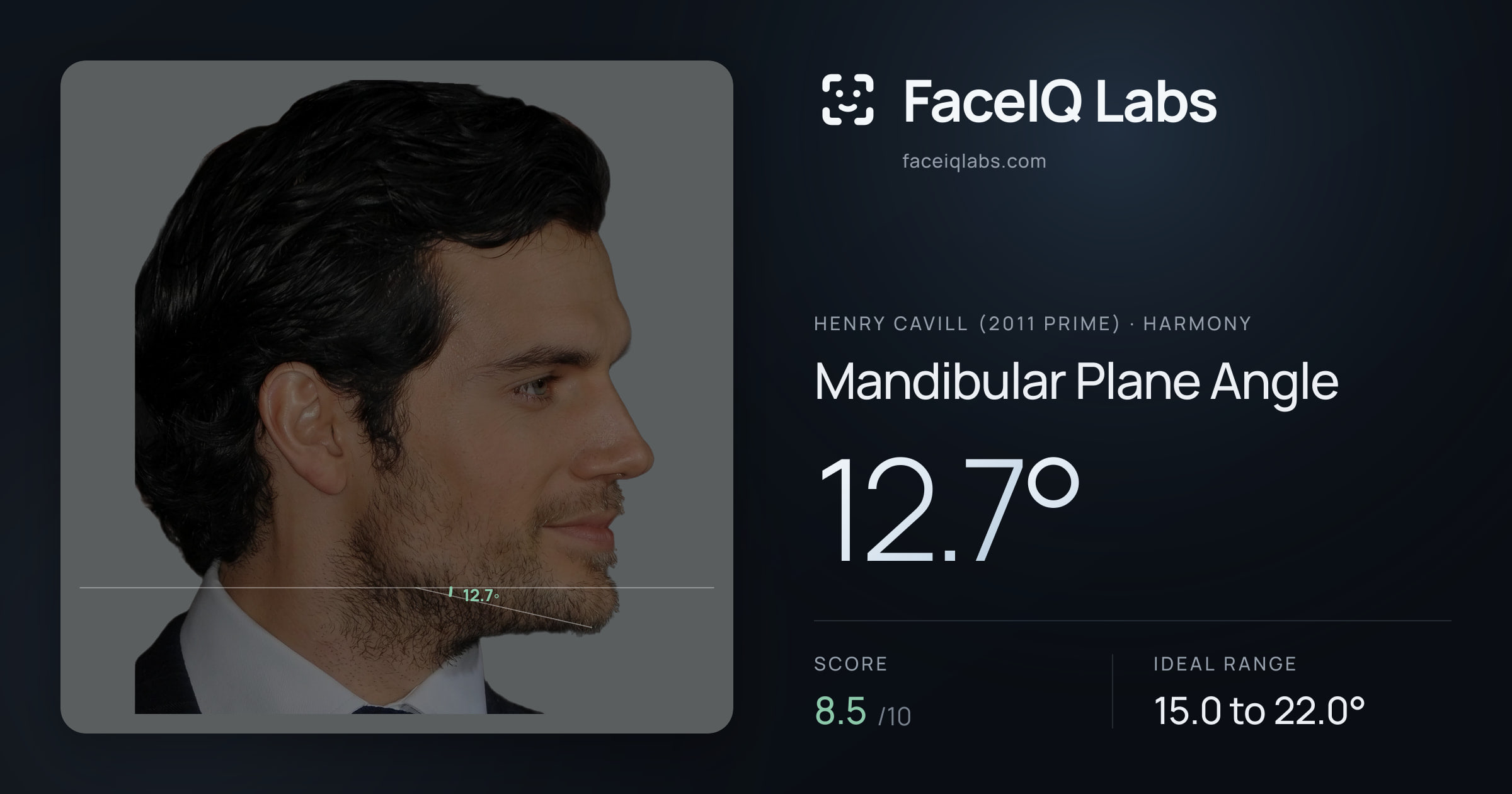 Henry Cavill (2011 Prime) Mandibular Plane Angle: 12.7°, drawn on the photo