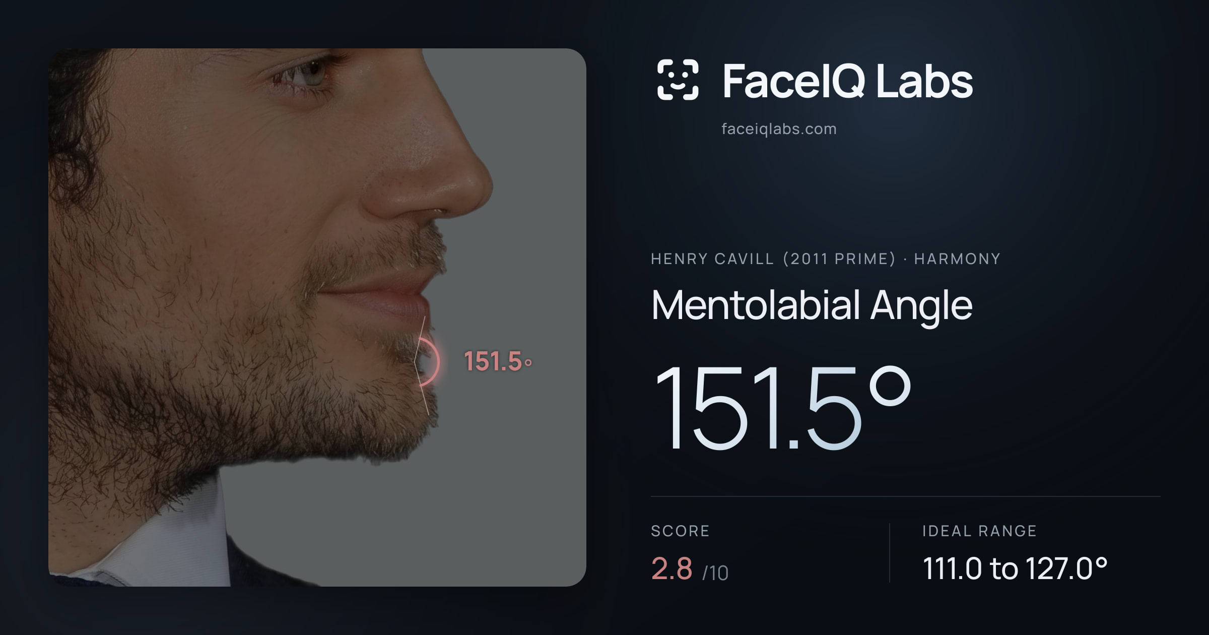 Henry Cavill (2011 Prime) Mentolabial Angle: 151.5°, drawn on the photo