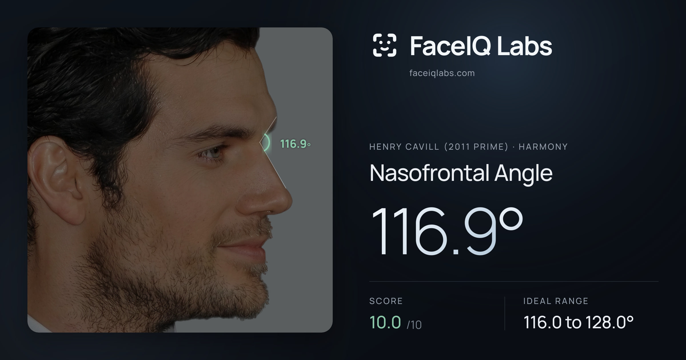 Henry Cavill (2011 Prime) Nasofrontal Angle: 116.9°, drawn on the photo
