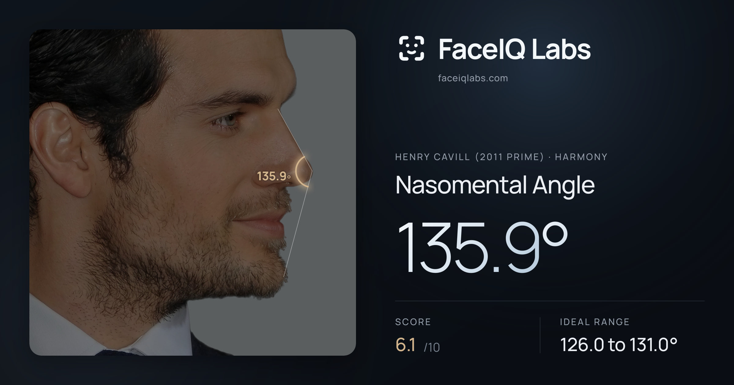 Henry Cavill (2011 Prime) Nasomental Angle: 135.9°, drawn on the photo