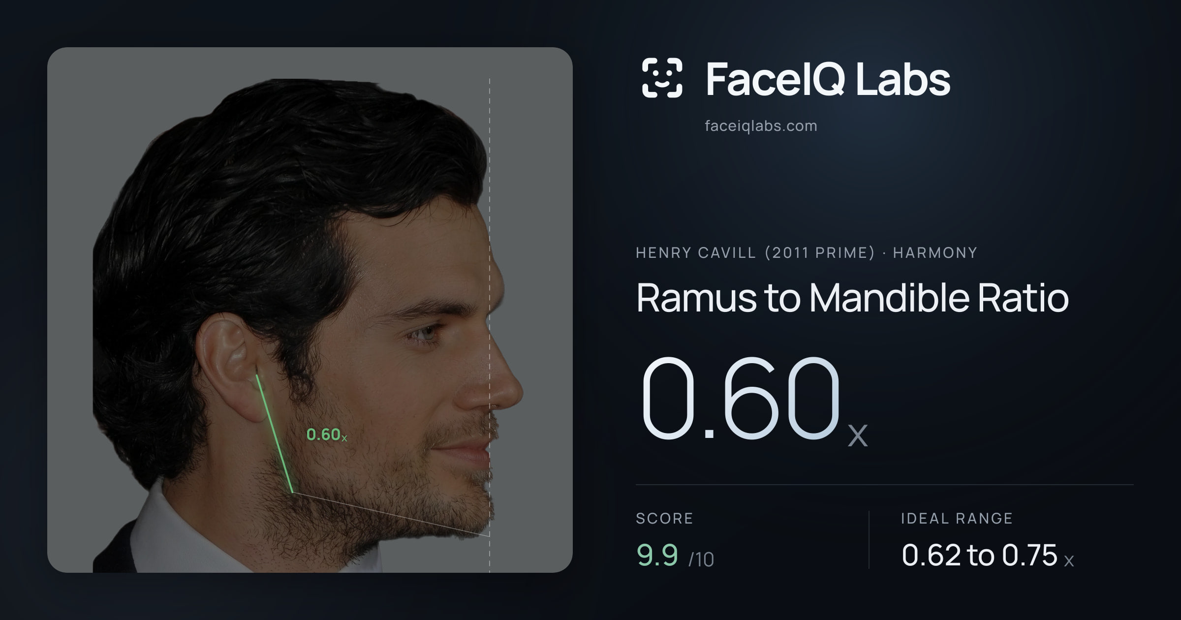 Henry Cavill (2011 Prime) Ramus to Mandible Ratio: 0.60x, drawn on the photo