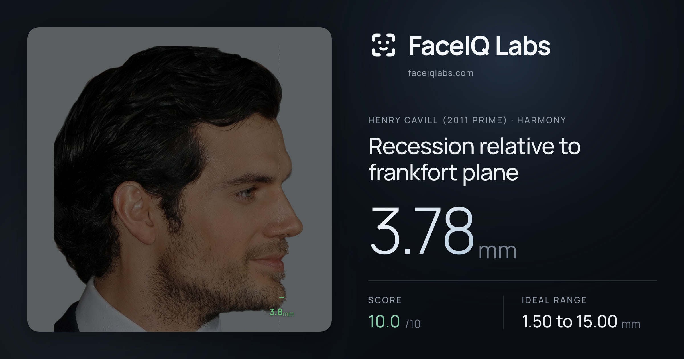 Henry Cavill (2011 Prime) Recession relative to frankfort plane: 3.78mm, drawn on the photo