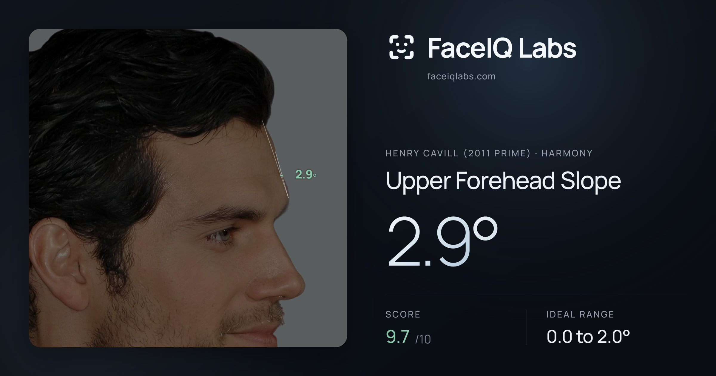 Henry Cavill (2011 Prime) Upper Forehead Slope: 2.9°, drawn on the photo