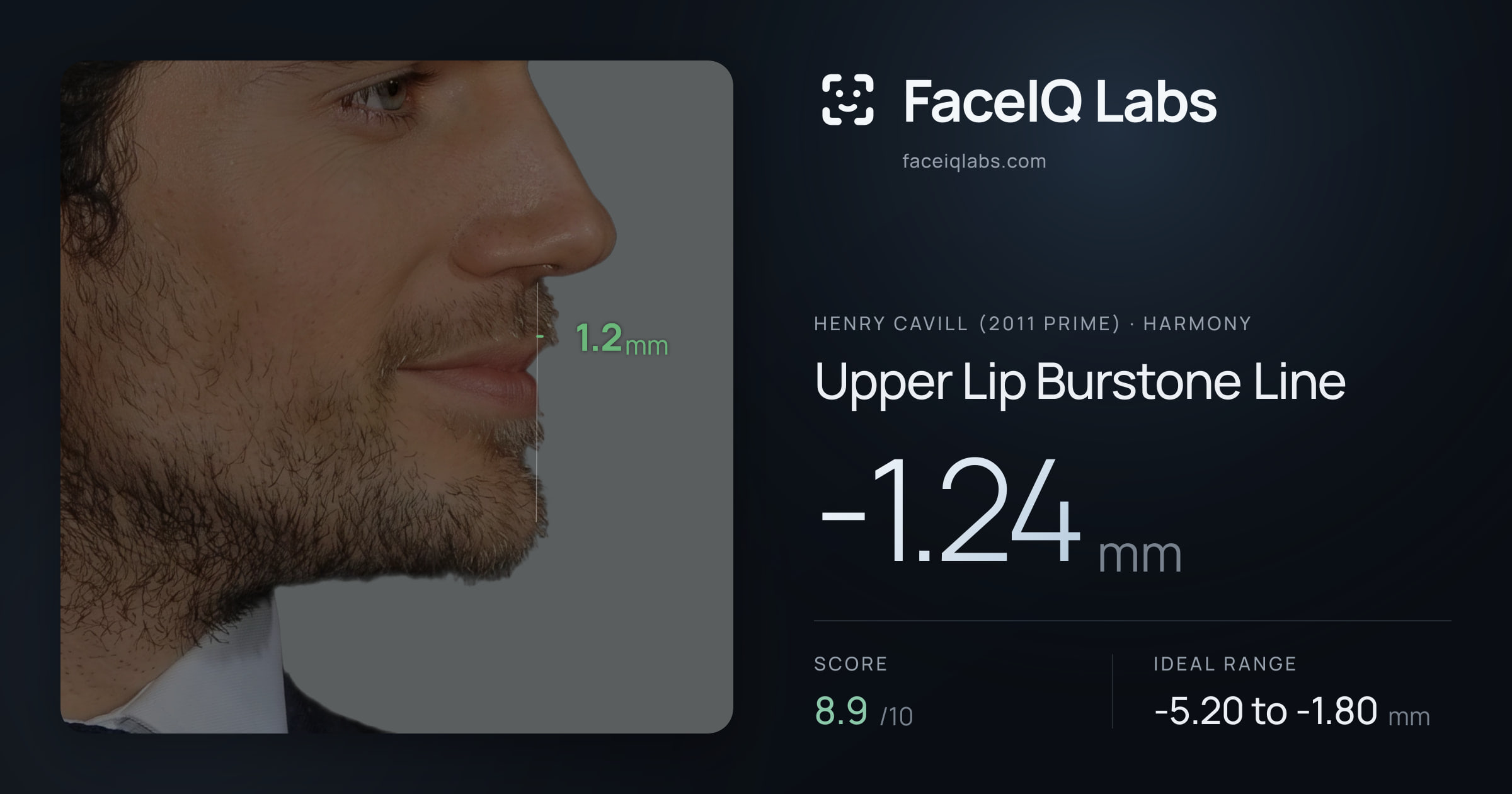 Henry Cavill (2011 Prime) Upper Lip Burstone Line: -1.24mm, drawn on the photo