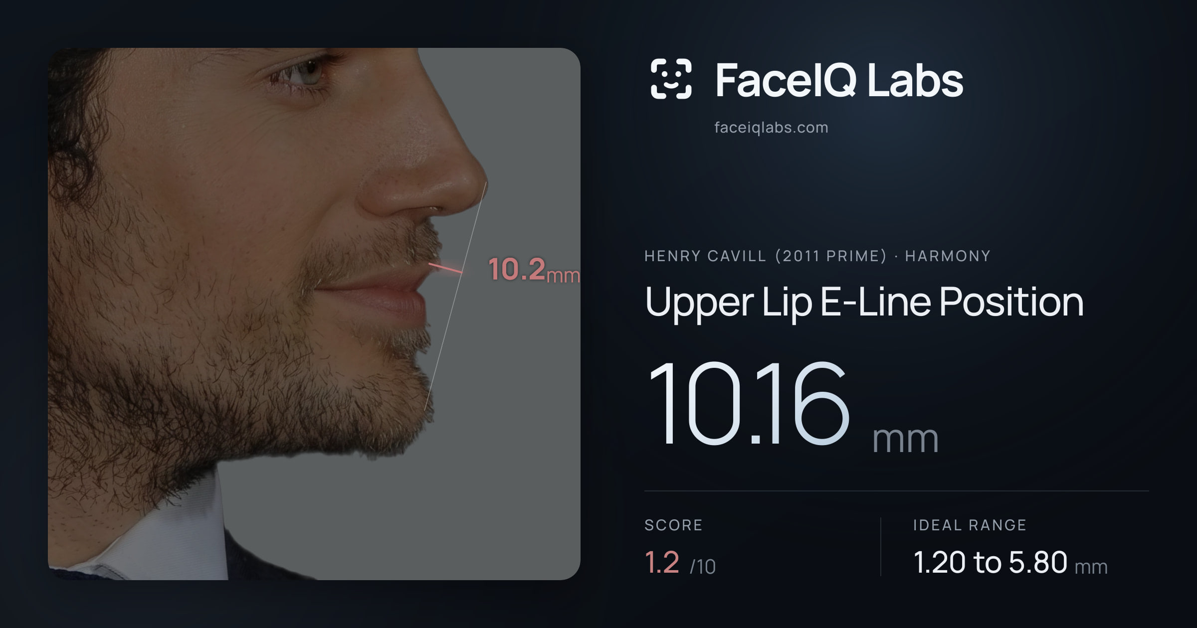 Henry Cavill (2011 Prime) Upper Lip E-Line Position: 10.16mm, drawn on the photo