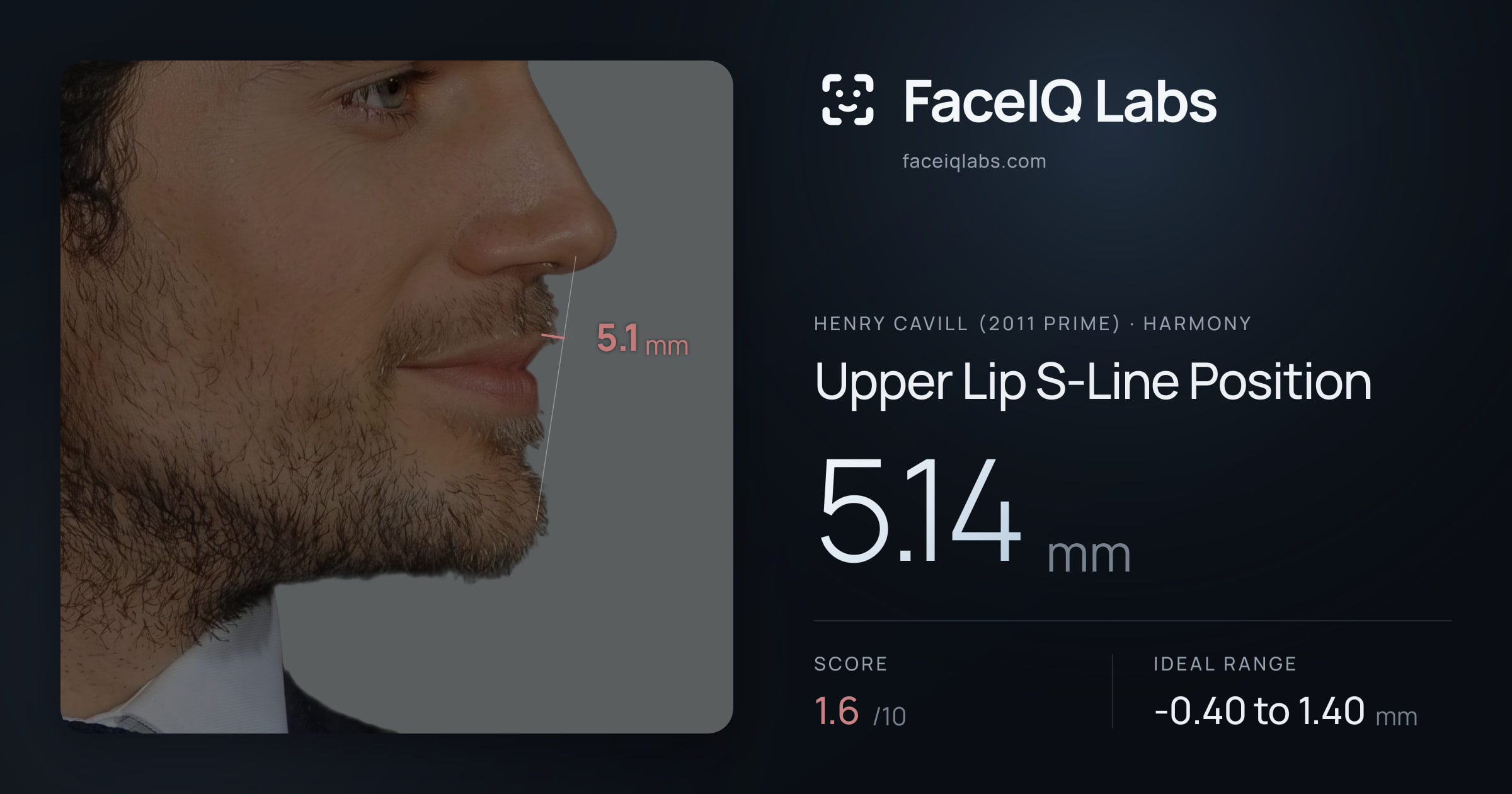 Henry Cavill (2011 Prime) Upper Lip S-Line Position: 5.14mm, drawn on the photo
