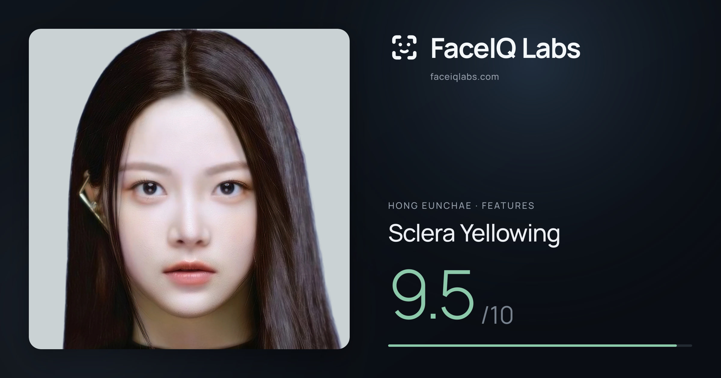 Hong Eunchae Sclera Yellowing: 9.5/10, drawn on the photo