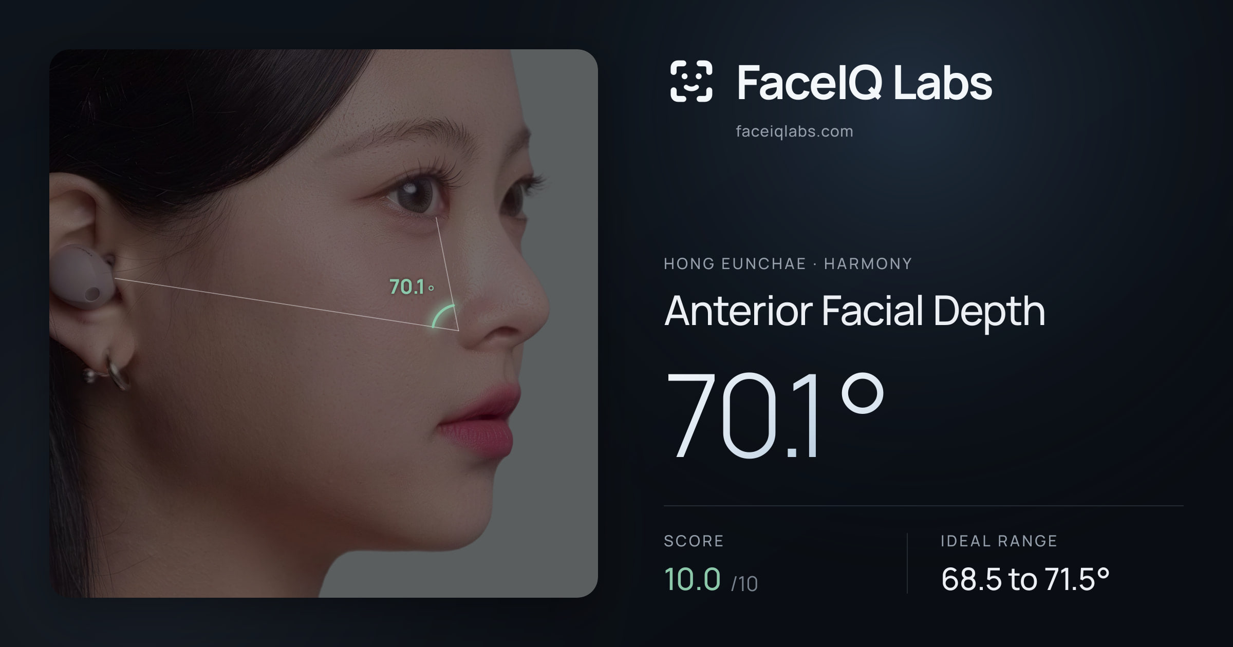 Hong Eunchae Anterior Facial Depth: 70.1°, drawn on the photo