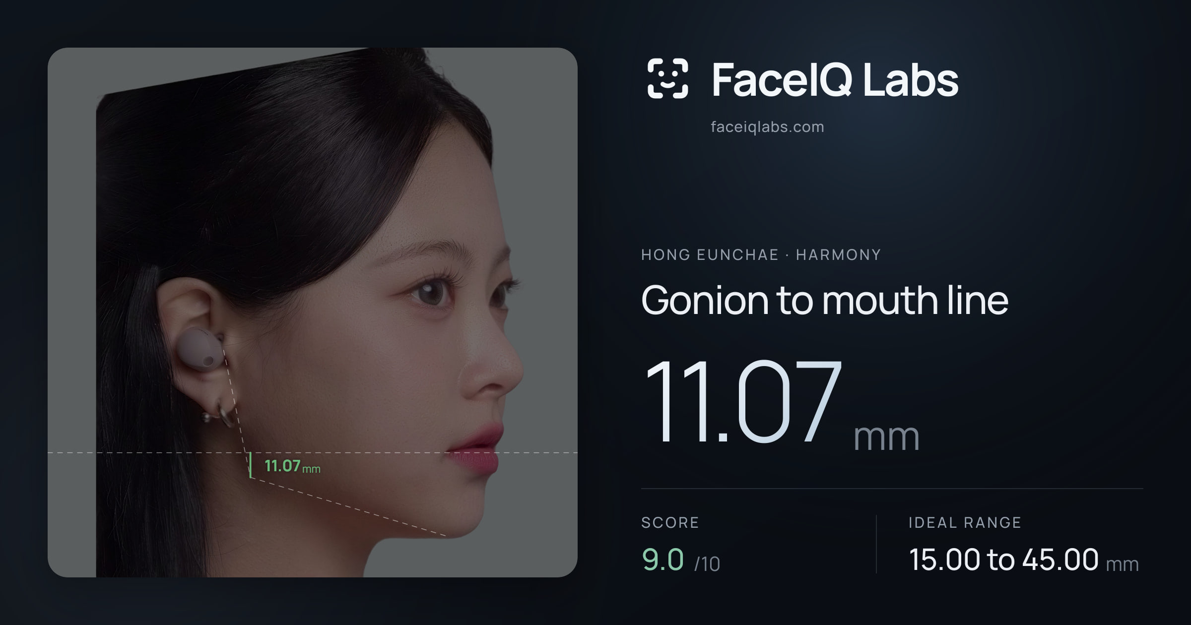 Hong Eunchae Gonion to mouth line: 11.07mm, drawn on the photo