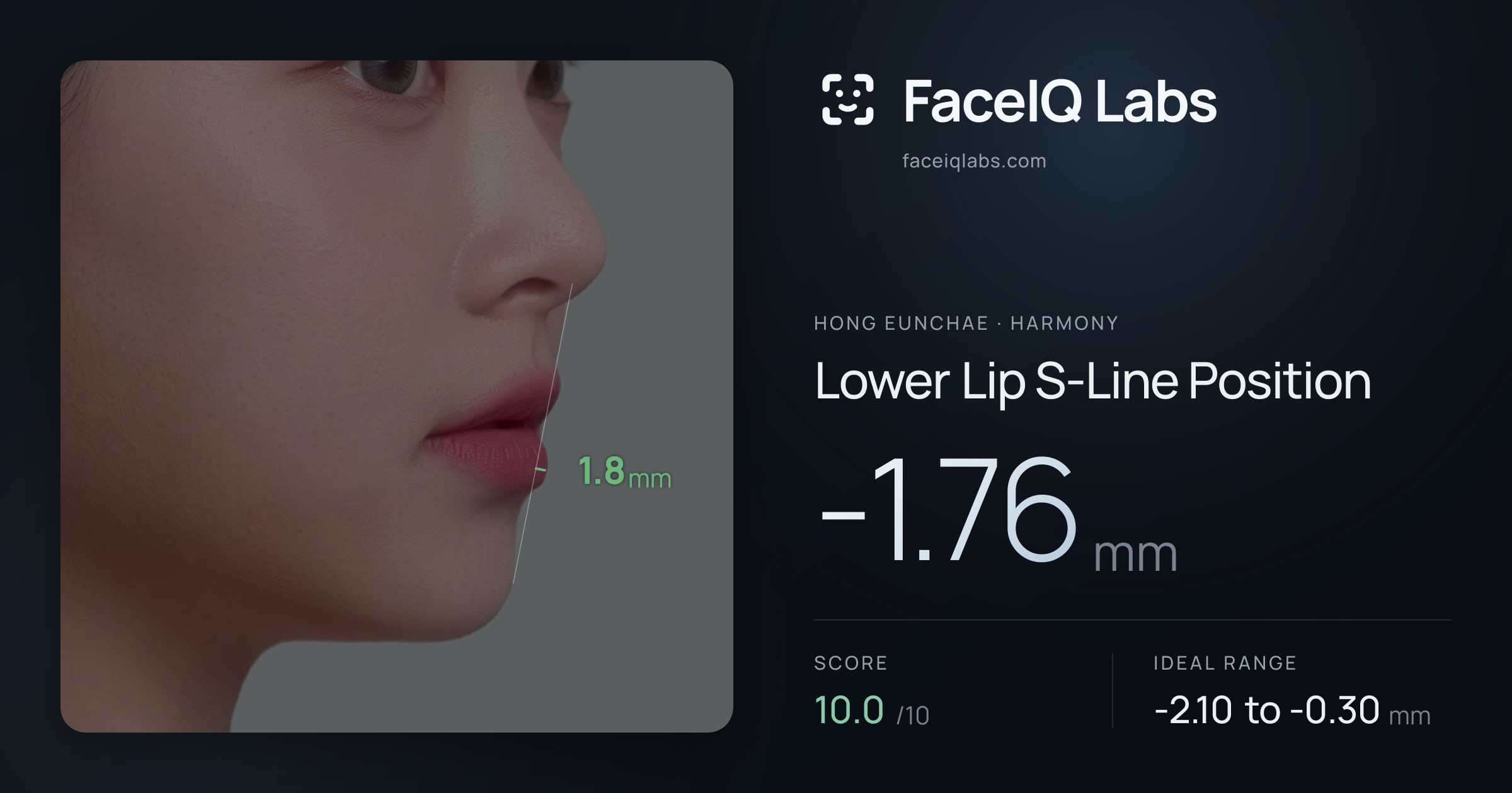 Hong Eunchae Lower Lip S-Line Position: -1.76mm, drawn on the photo