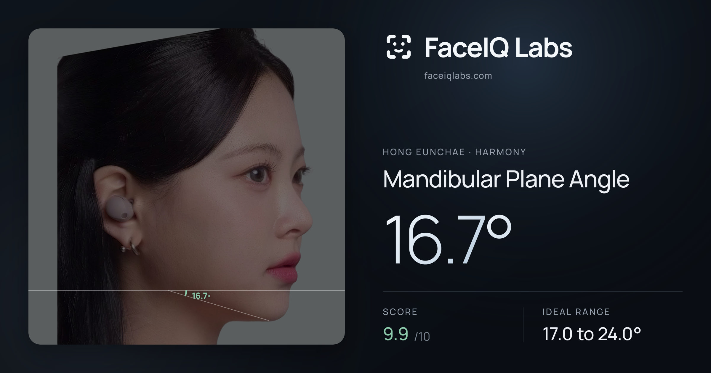 Hong Eunchae Mandibular Plane Angle: 16.7°, drawn on the photo