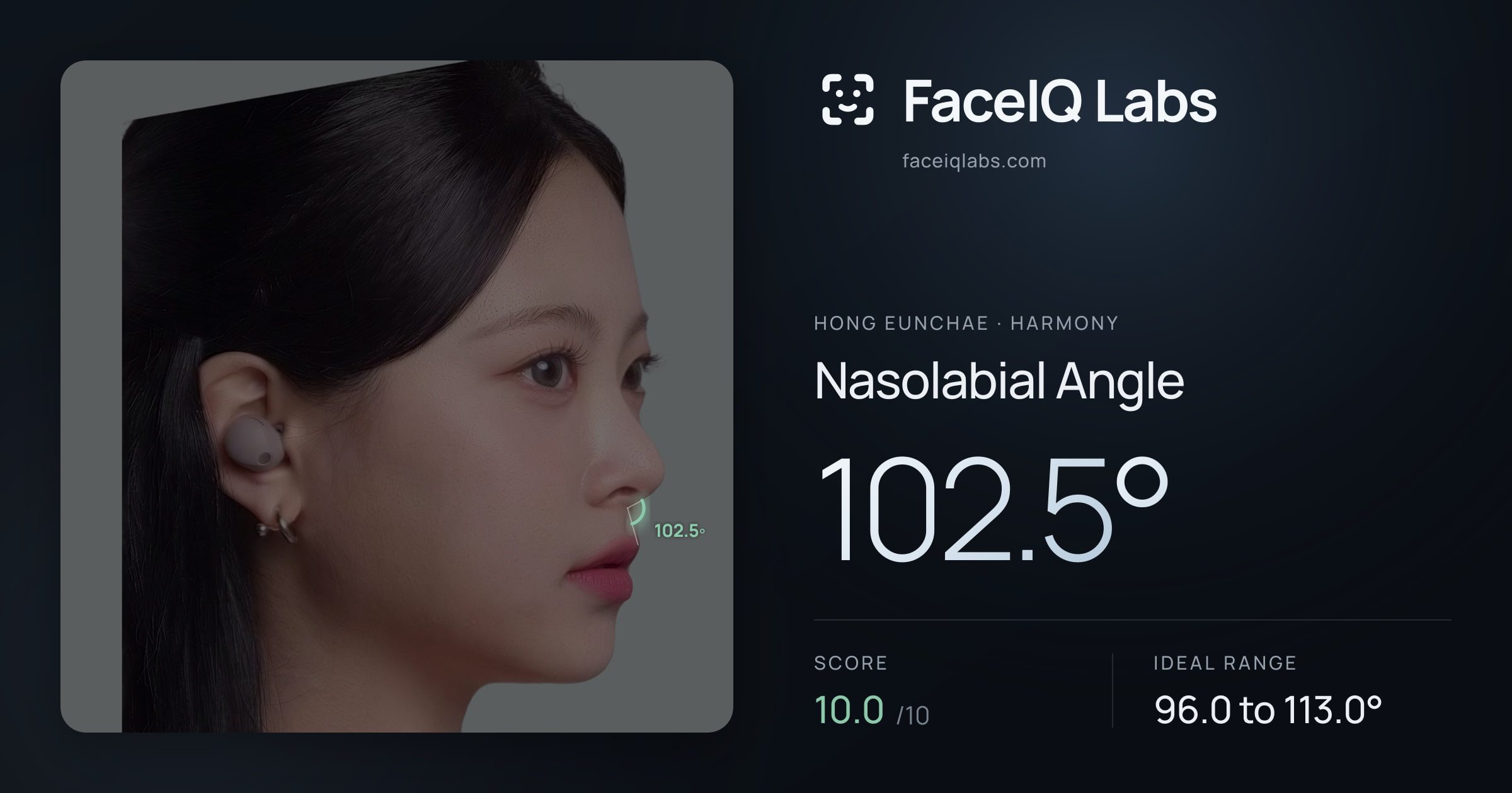 Hong Eunchae Nasolabial Angle: 102.5°, drawn on the photo