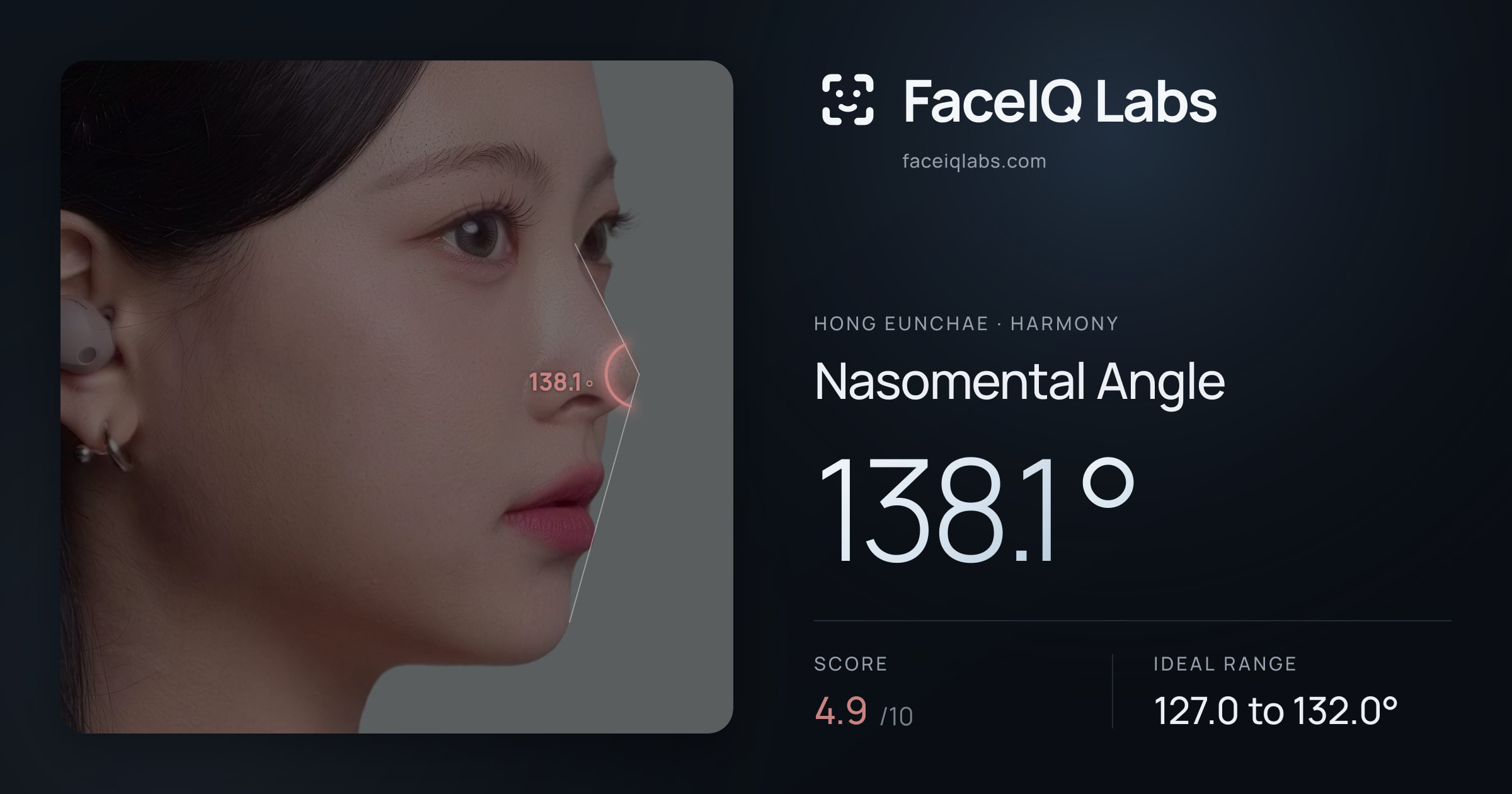 Hong Eunchae Nasomental Angle: 138.1°, drawn on the photo