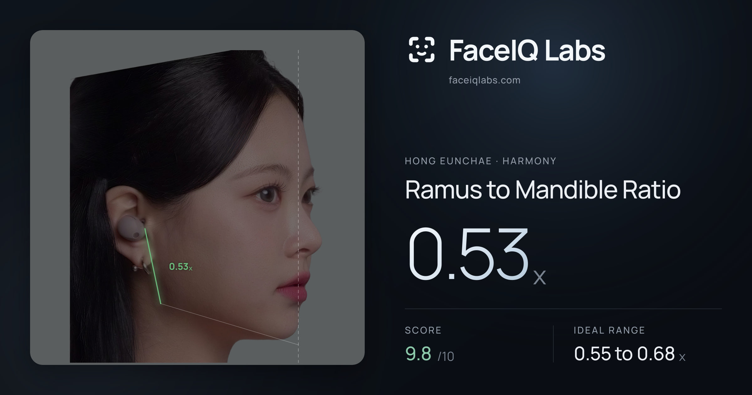 Hong Eunchae Ramus to Mandible Ratio: 0.53x, drawn on the photo