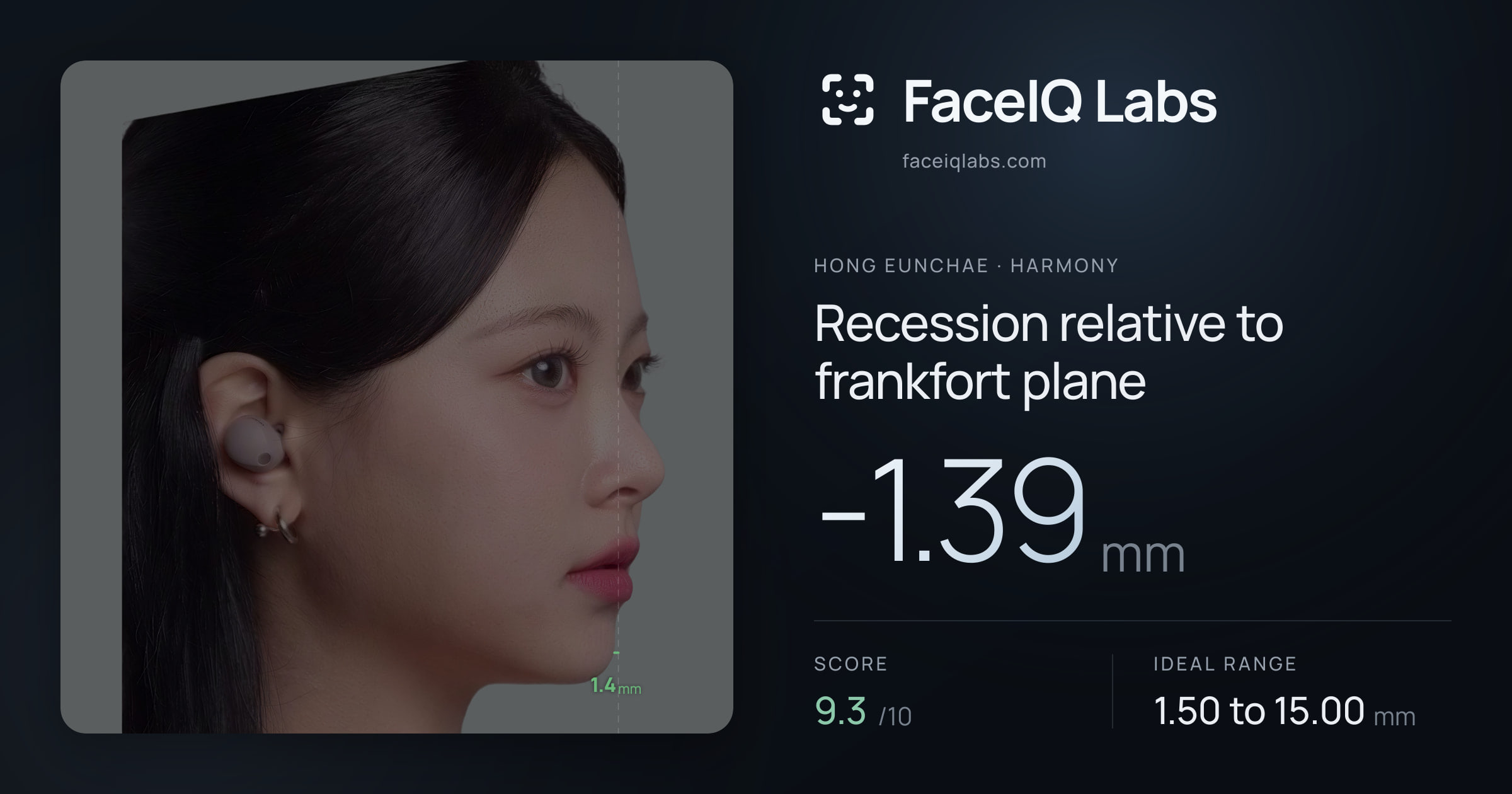Hong Eunchae Recession relative to frankfort plane: -1.39mm, drawn on the photo