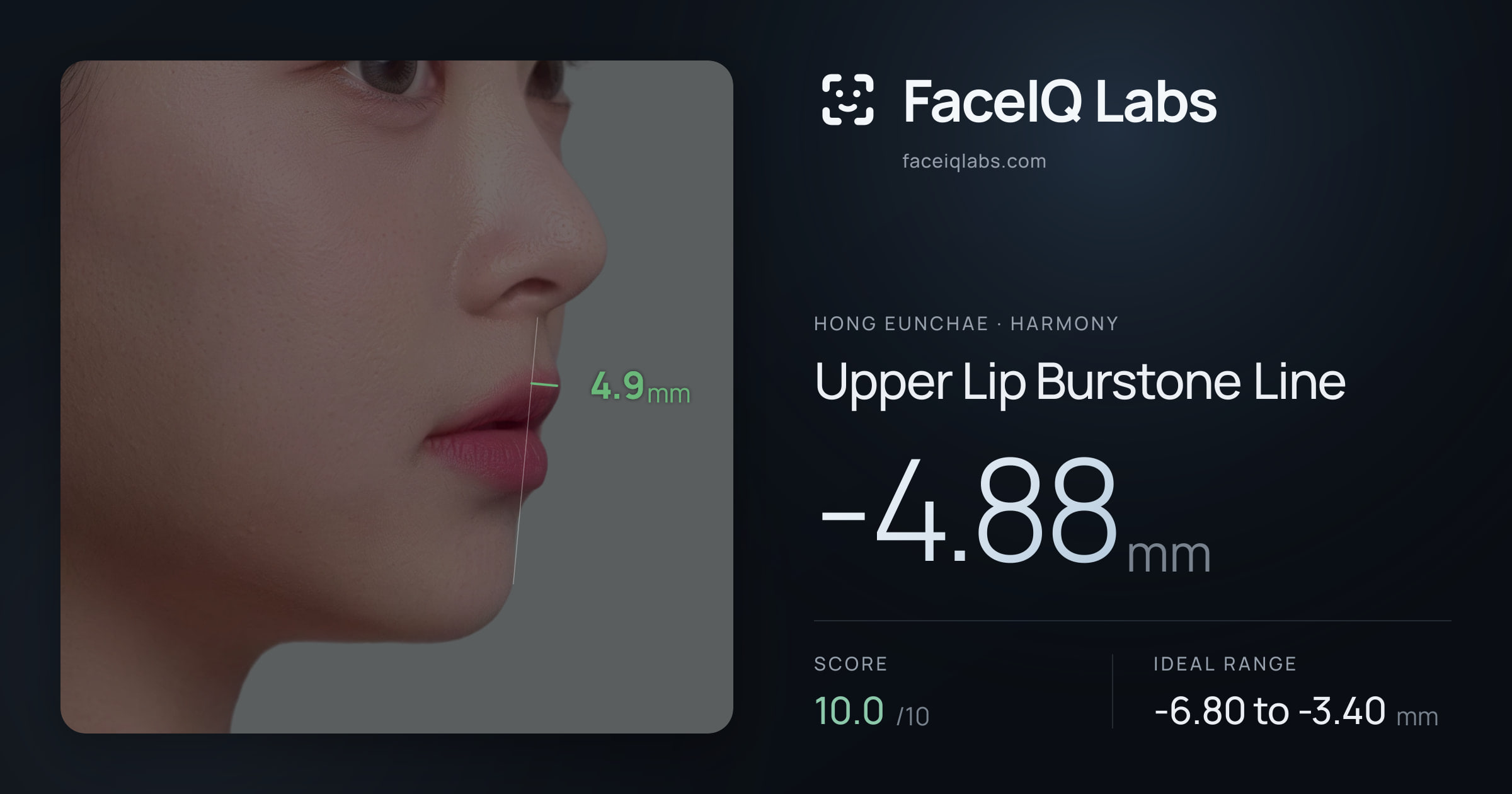 Hong Eunchae Upper Lip Burstone Line: -4.88mm, drawn on the photo