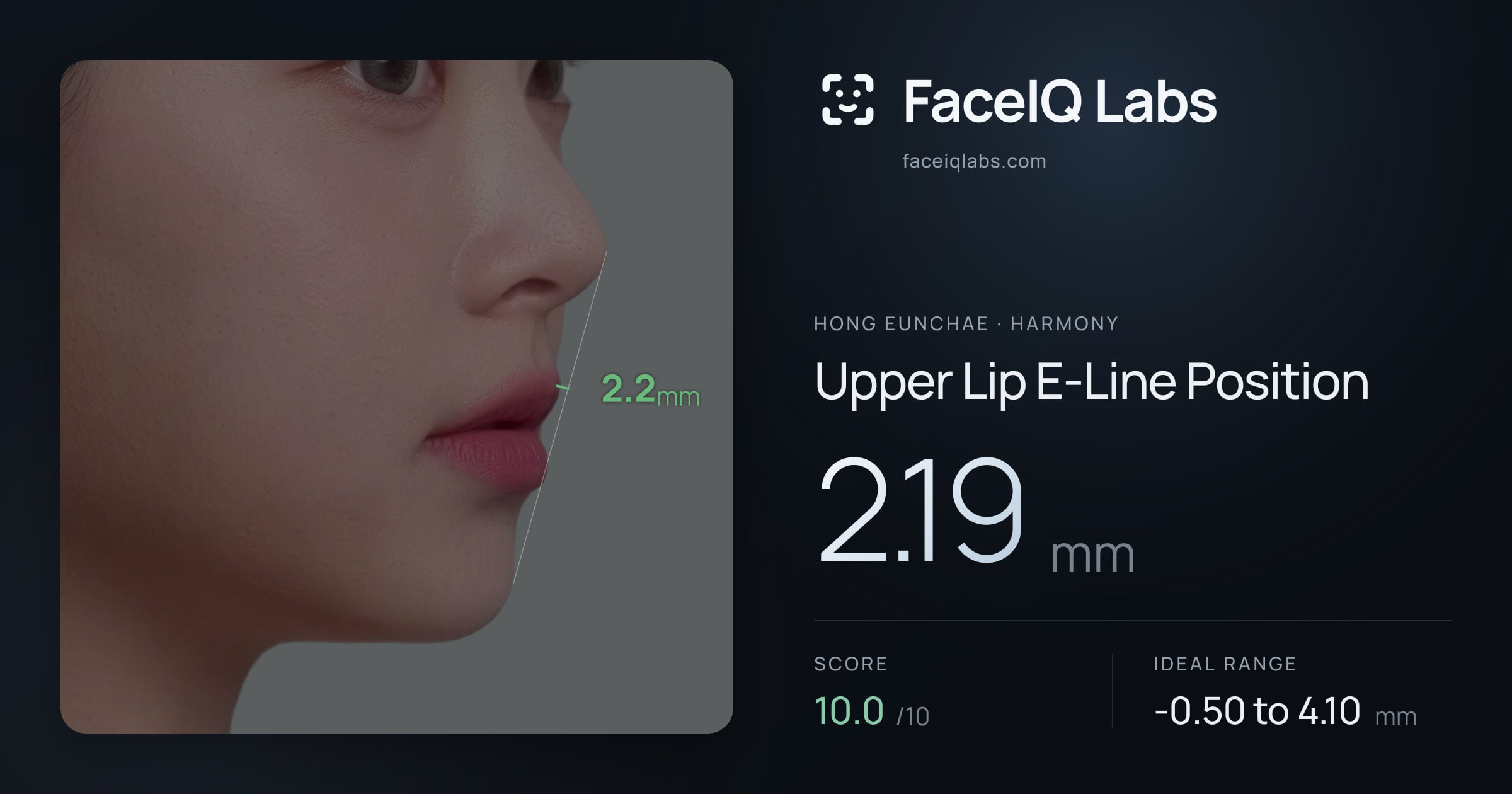 Hong Eunchae Upper Lip E-Line Position: 2.19mm, drawn on the photo